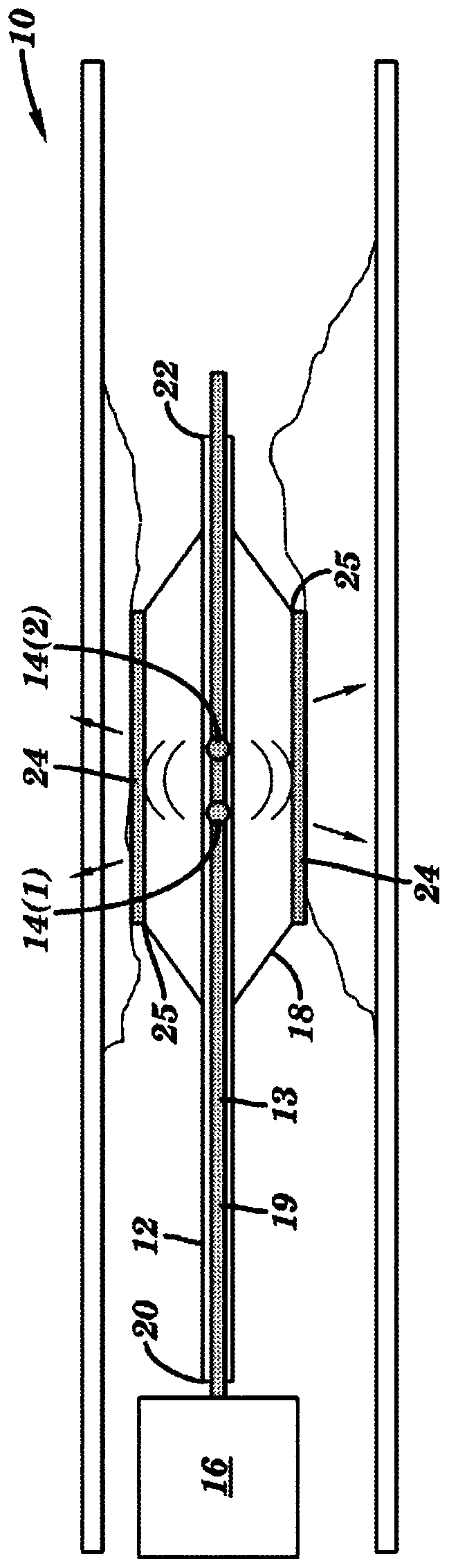 Method and device for enhanced composition delivery