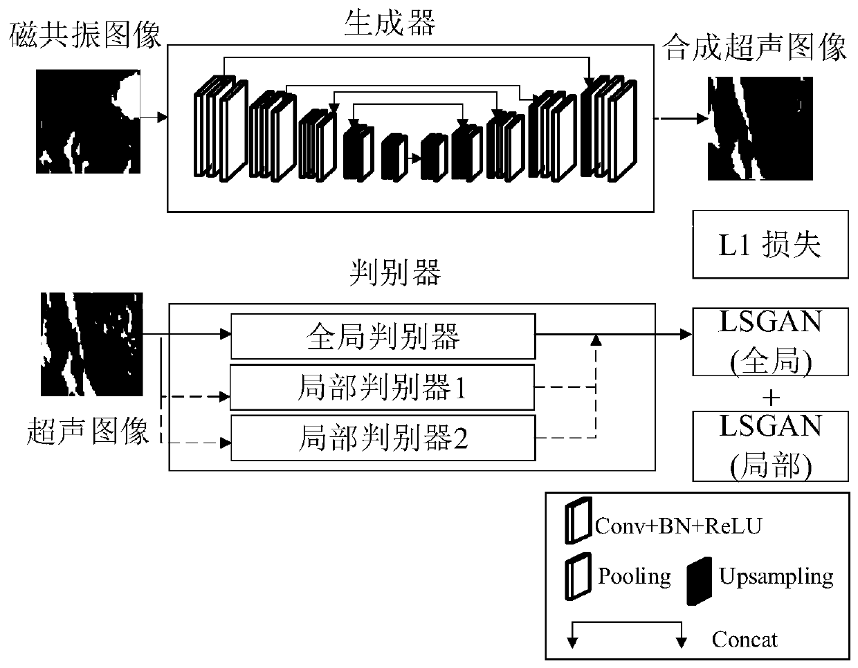 Multi-modal image registration method based on synthetic ultrasonic image