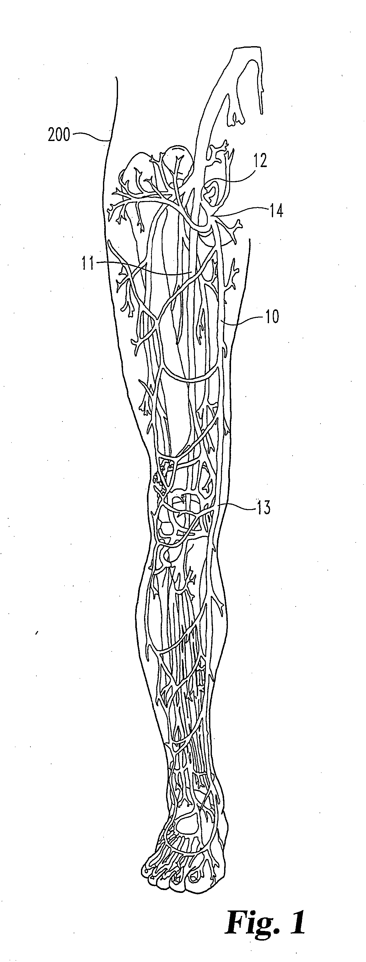 Methods, systems and devices for the delivery of endoluminal prostheses