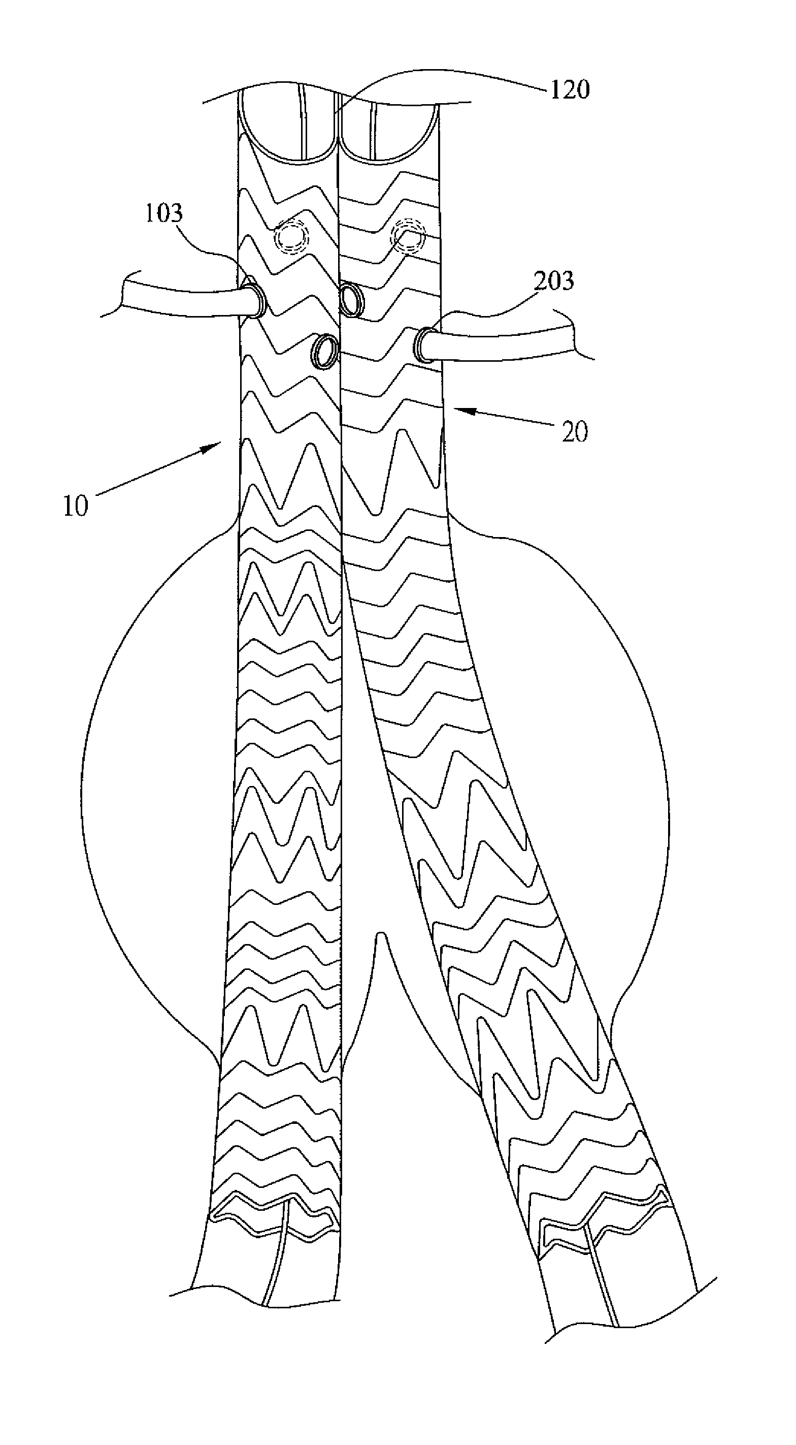 Abdominal aortic stent