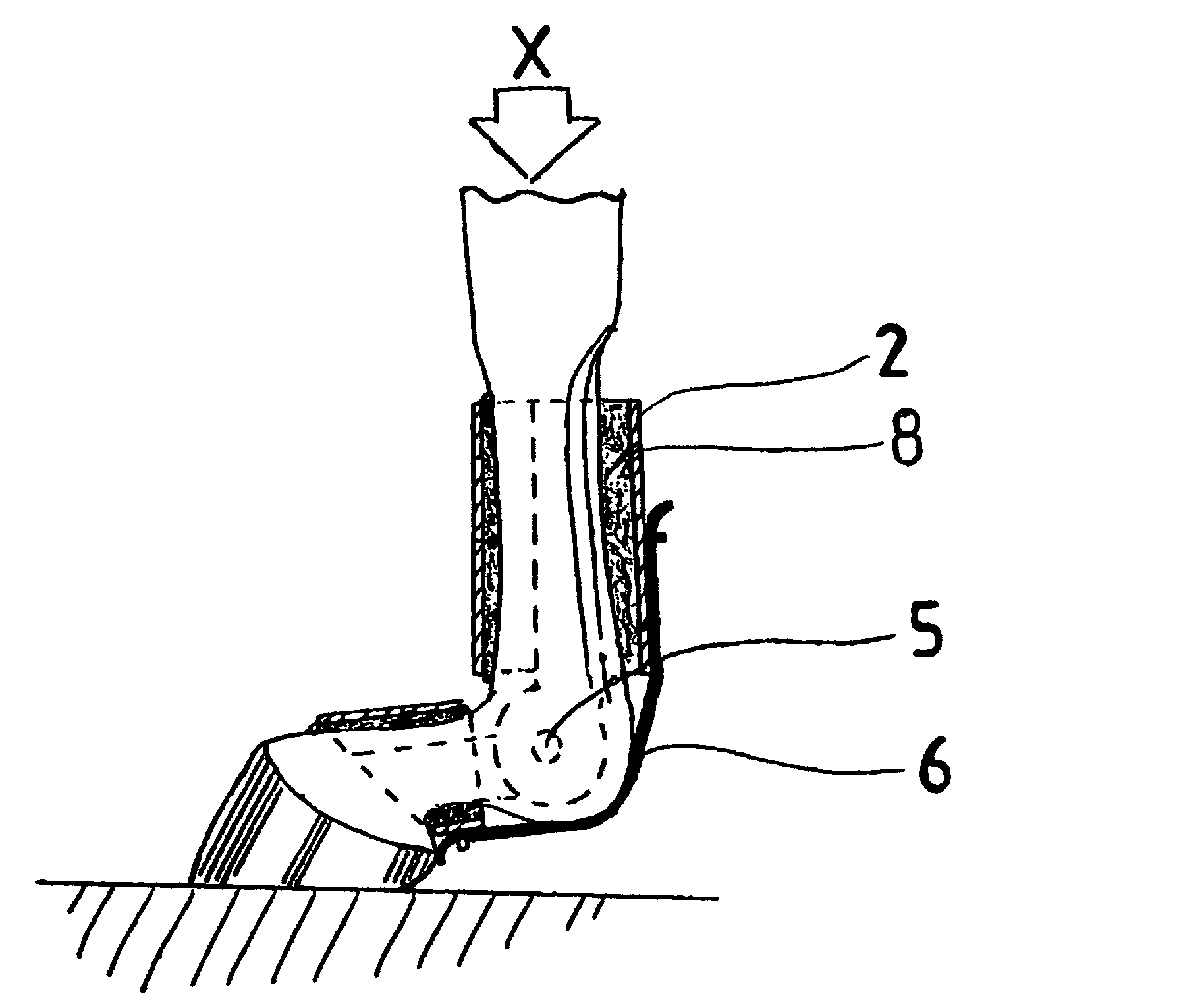 Tendon and ligament support for horse's fetlock joint