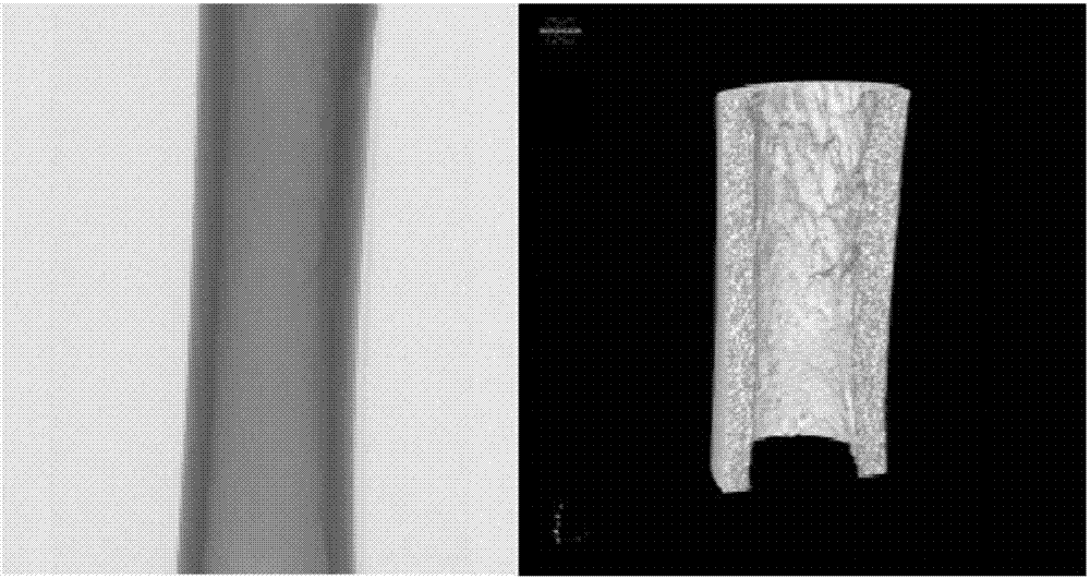 Bone repair biological ceramic scaffold material formed through individualized customization based on photocuring 3D printing technology and preparation method of bone repair biological ceramic scaffold material