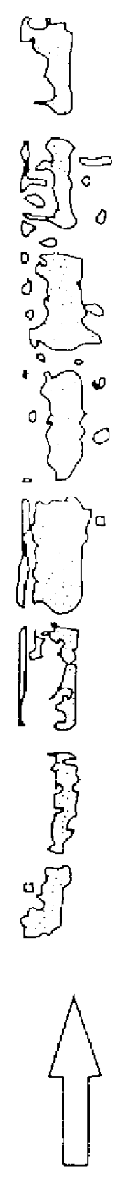 Measurement of a CNS protein in cerebrospinal or amniotic fluid