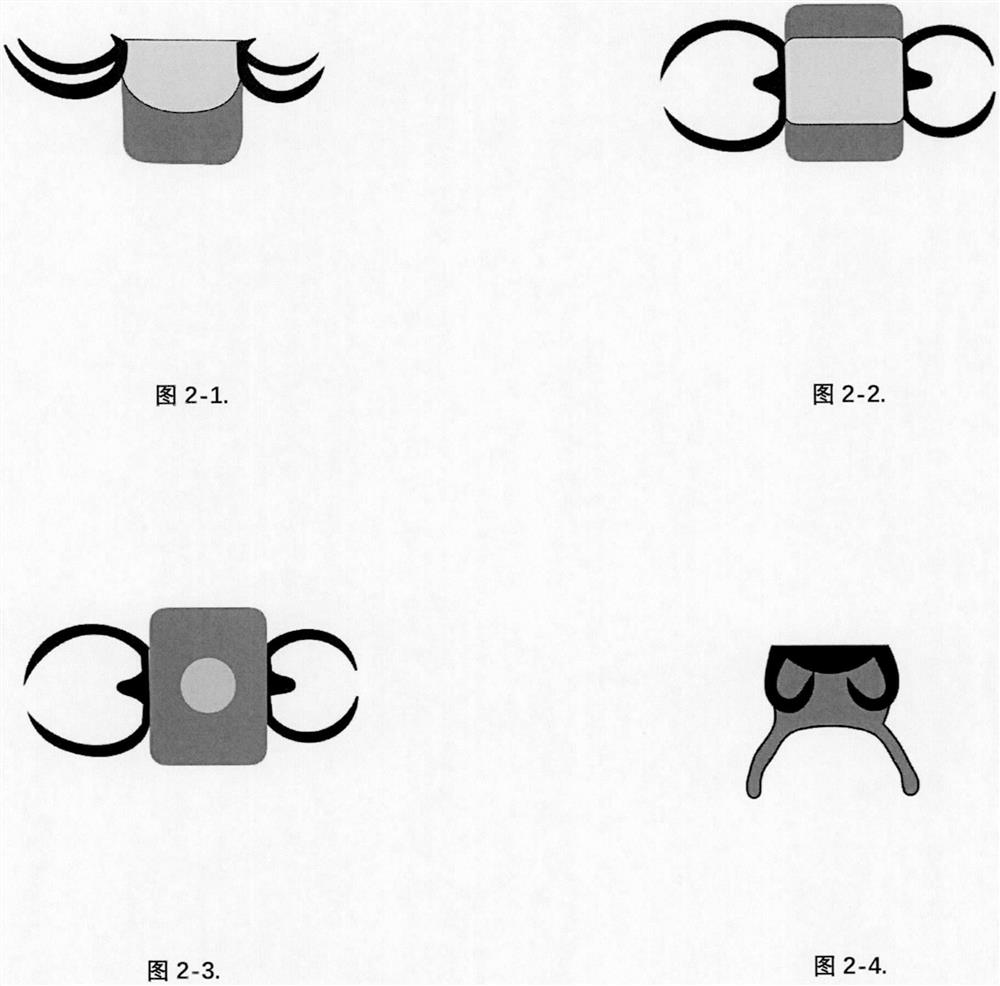 Moving device and method for depressing overlong maxillary posterior teeth