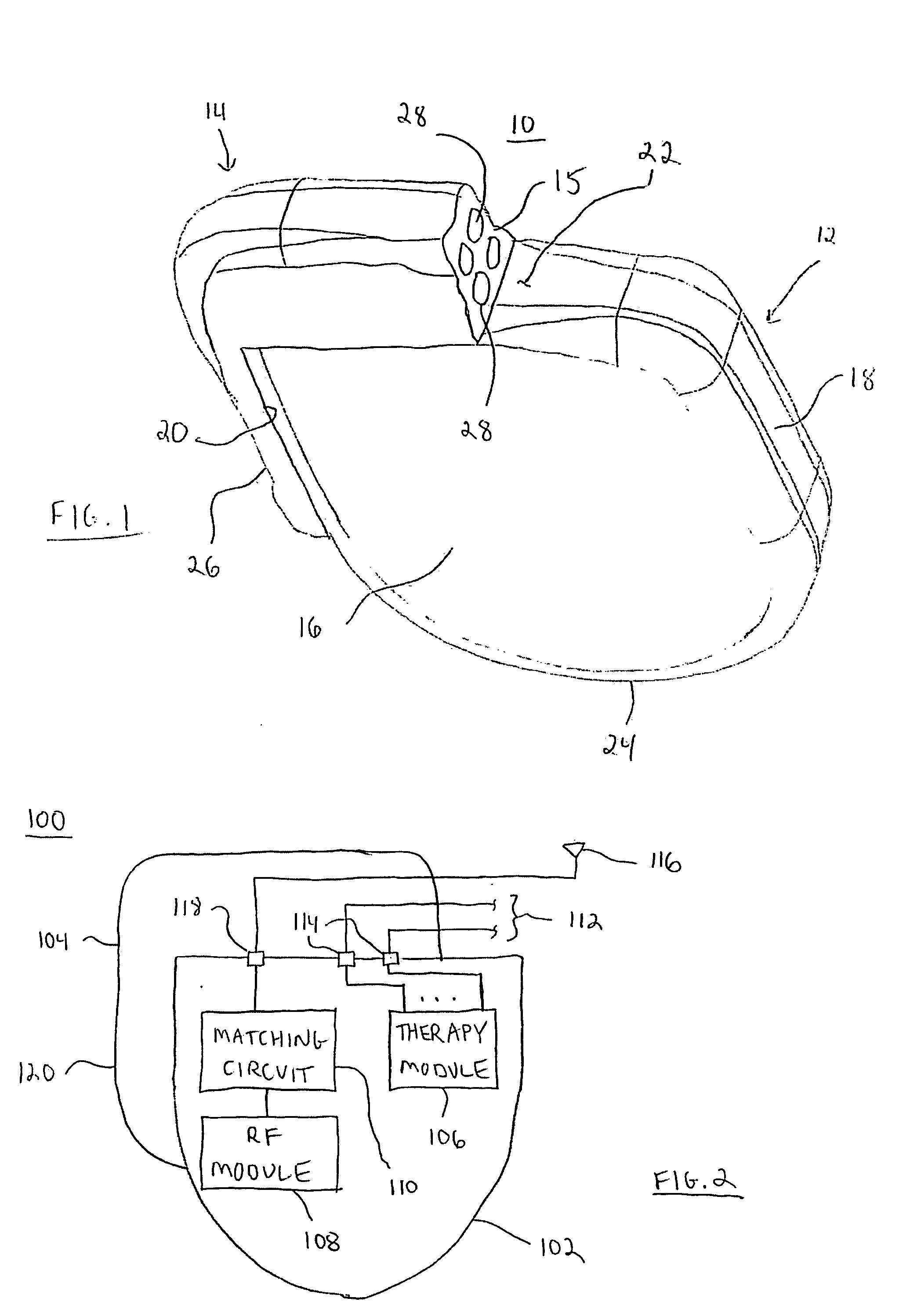 Optional telemetry antenna for implantable medical devices