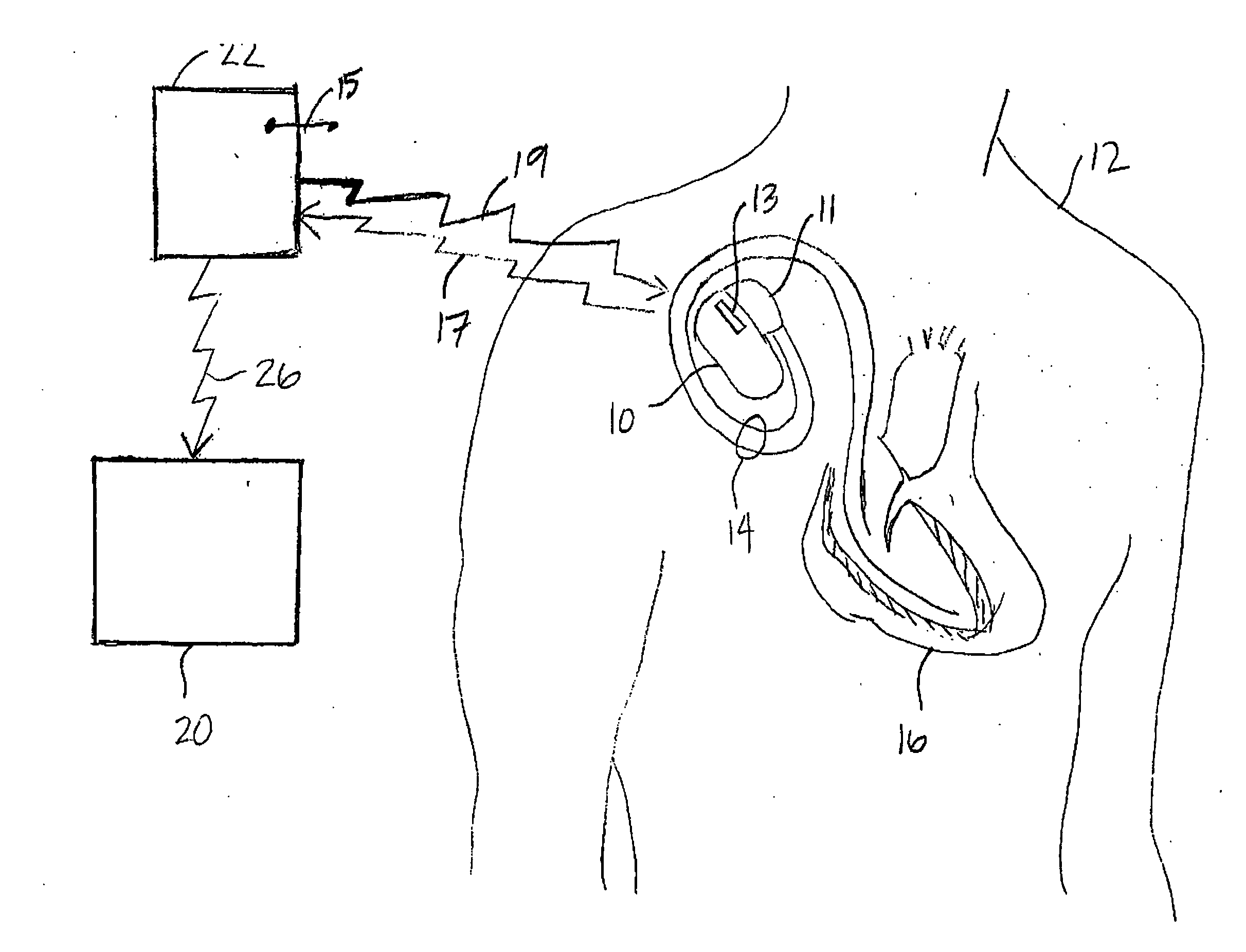 Implantable medical device system with communication link to home appliances
