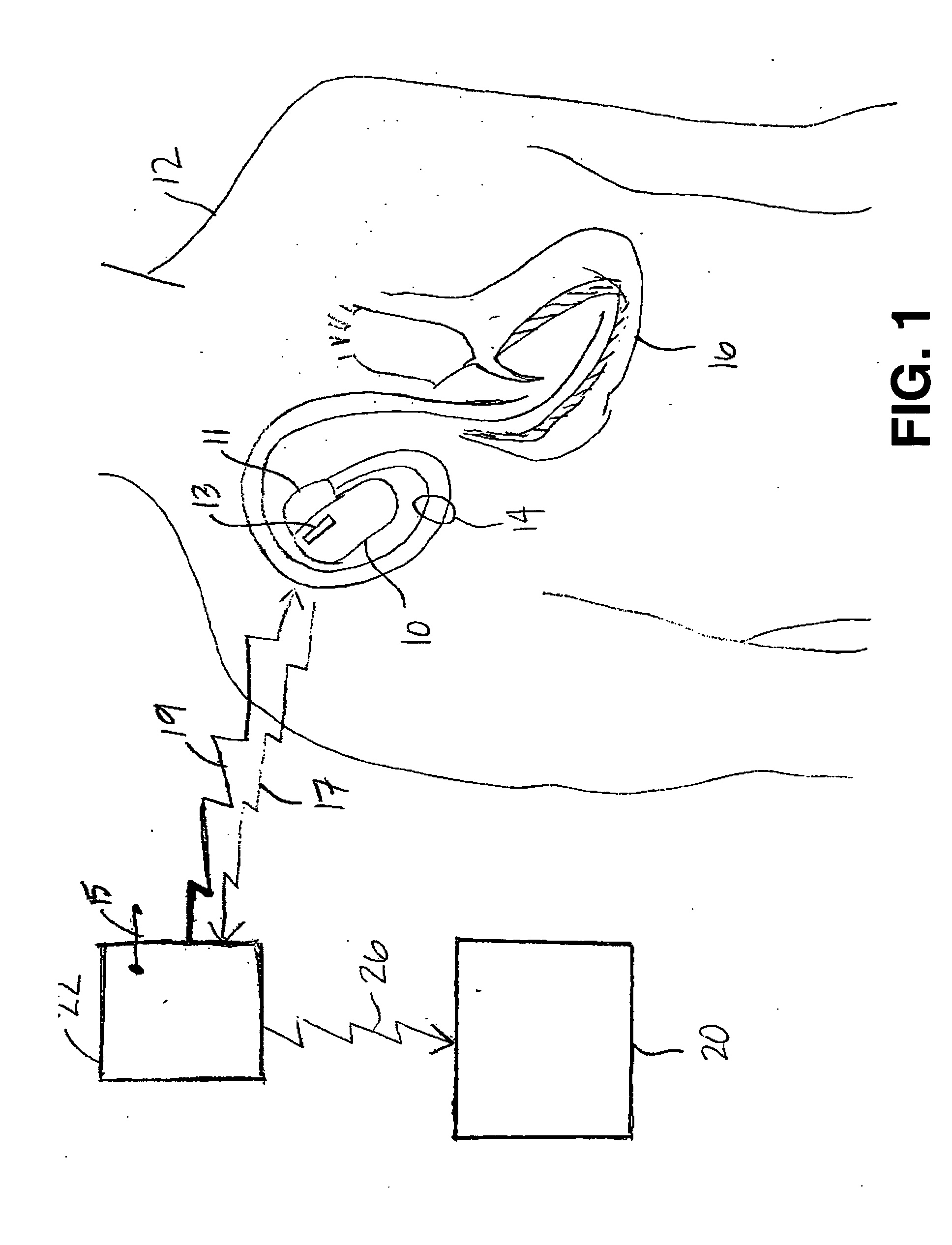 Implantable medical device system with communication link to home appliances