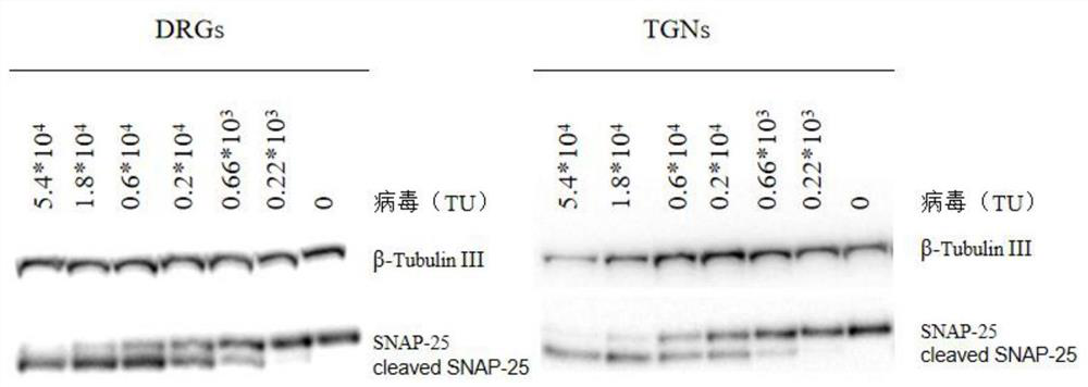 Expression unit, recombinant lentivirus expression vector, recombinant lentivirus and preparation method and application of recombinant lentivirus