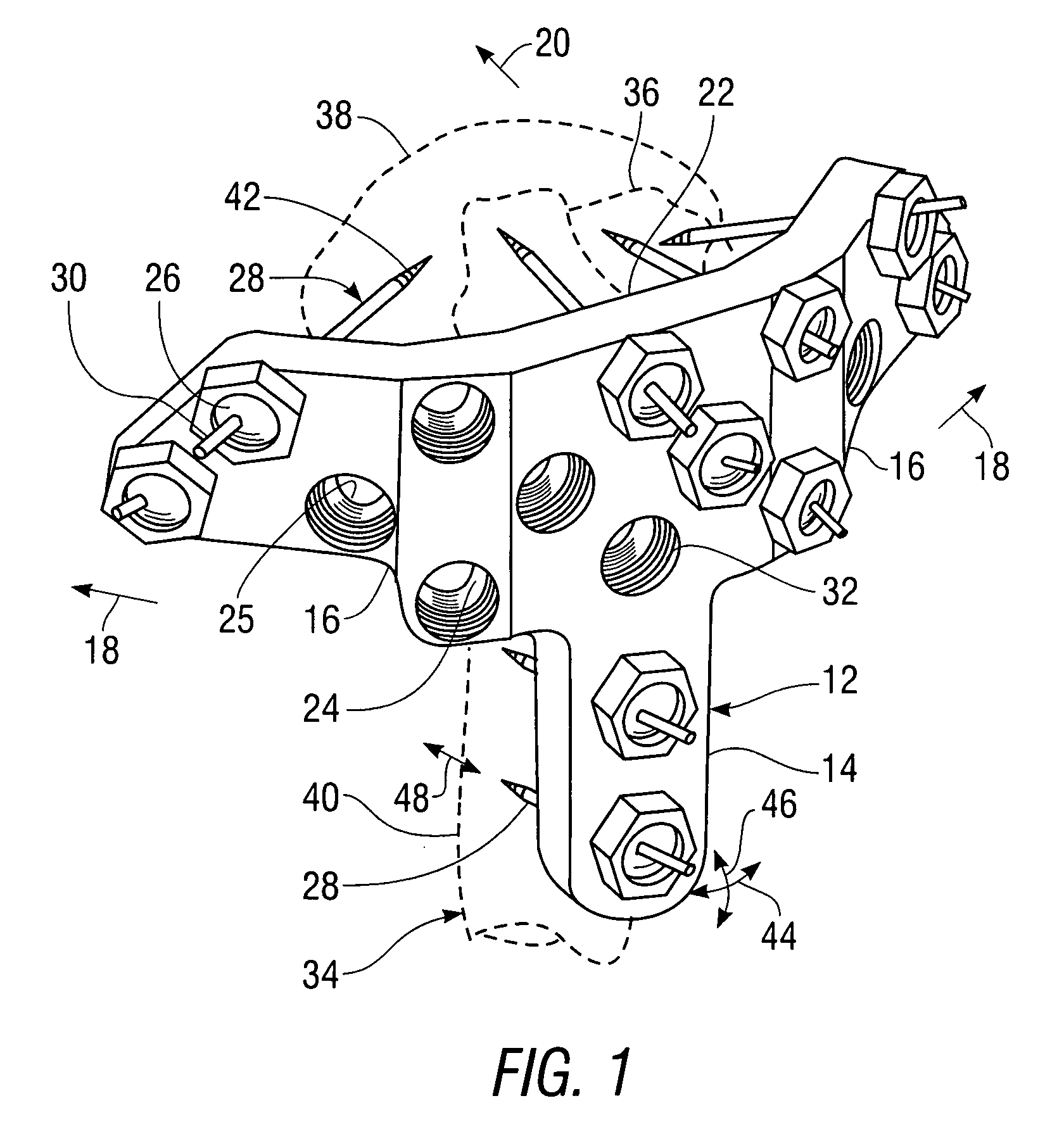 Apparatus for external fixation of a fractured distal radius with angularly adjustable pin clamping means