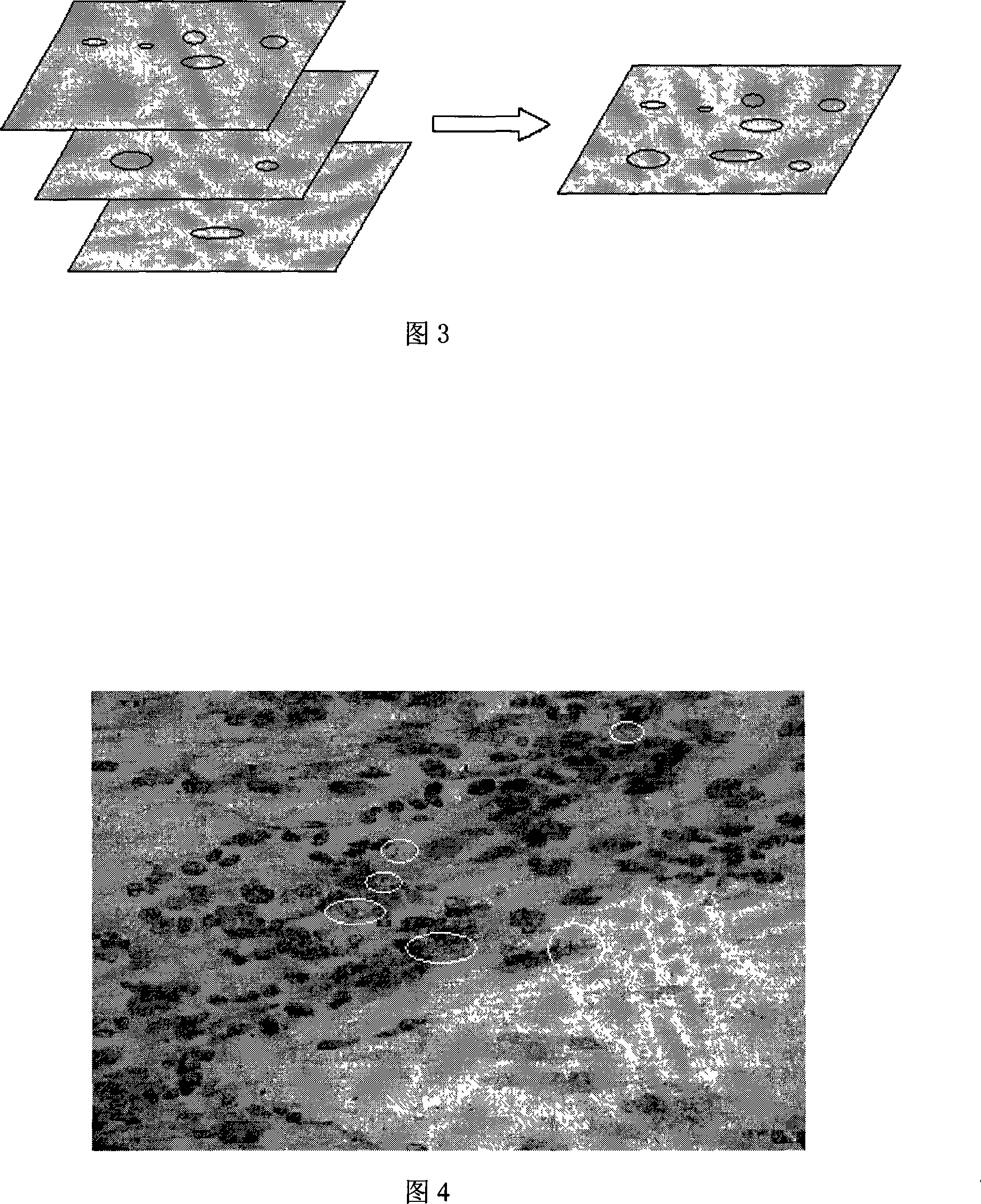 System and method for intelligent recognizing and counting sputum smear micro-image tubercle bacillus