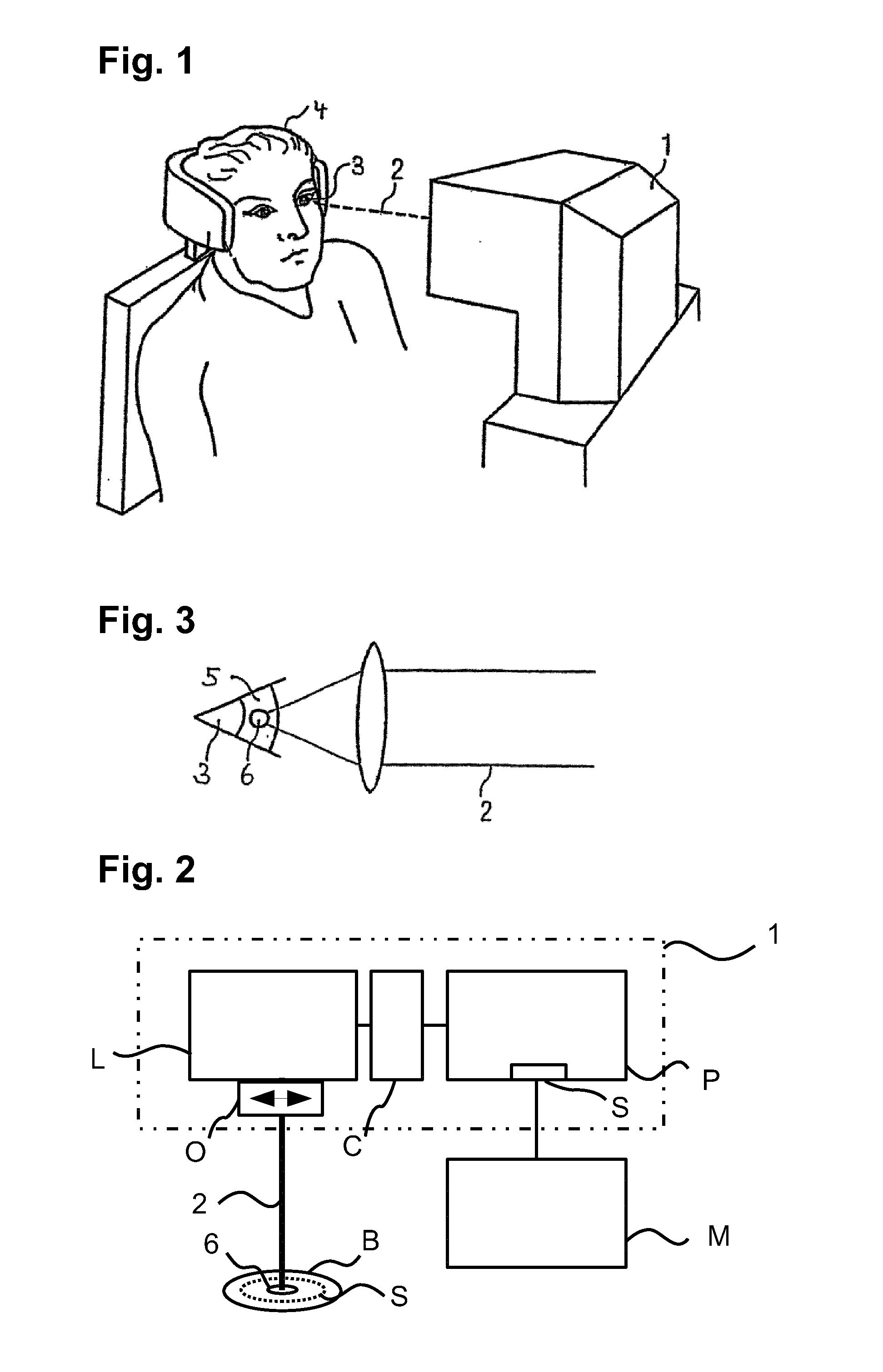 Producing cut surfaces in a transparent material by means of optical radiation