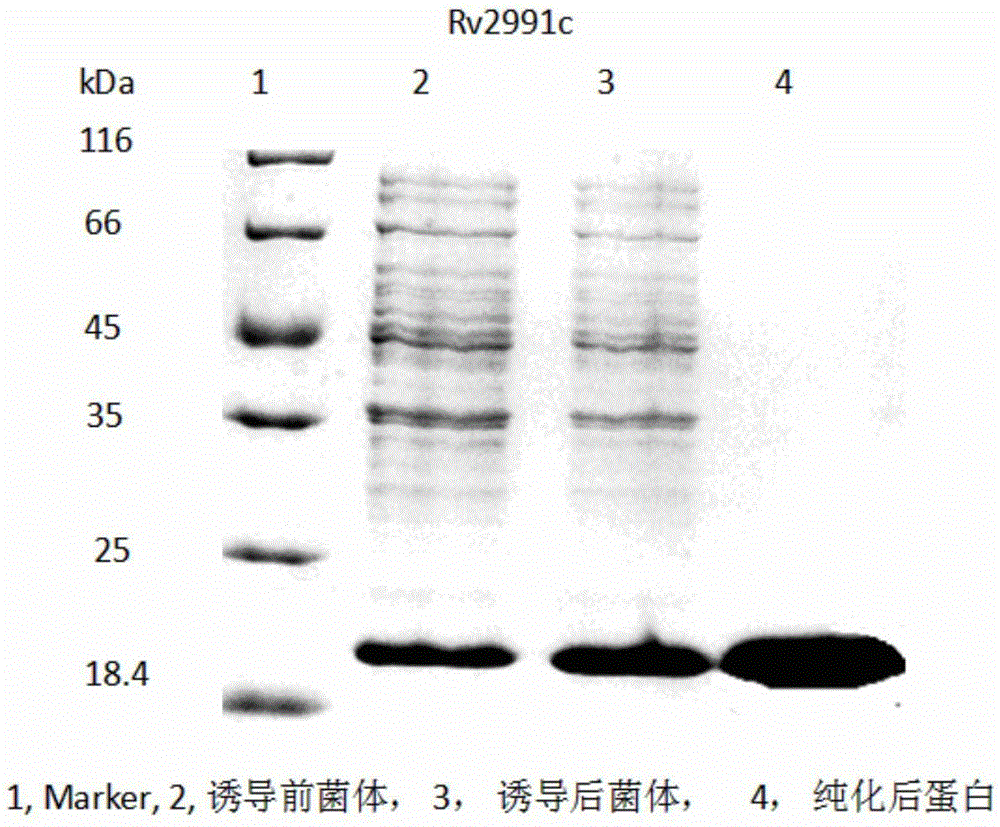 Mycobacterium tuberculosis Rv 2991 recombinant protein, preparation method and application of mycobacterium tuberculosis Rv 2991 recombinant protein