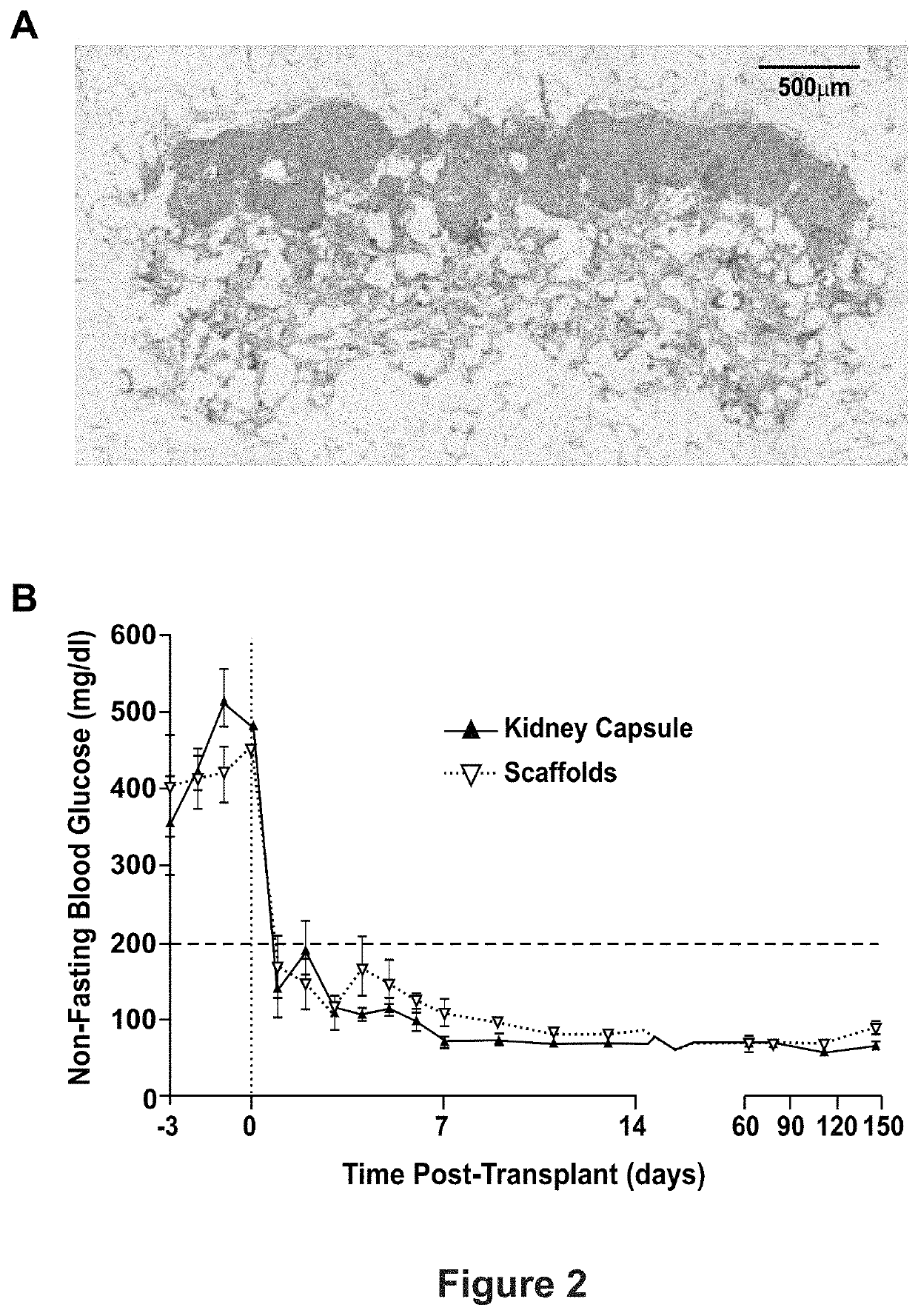 Microporous hydrogel scaffolds for cell transplantation