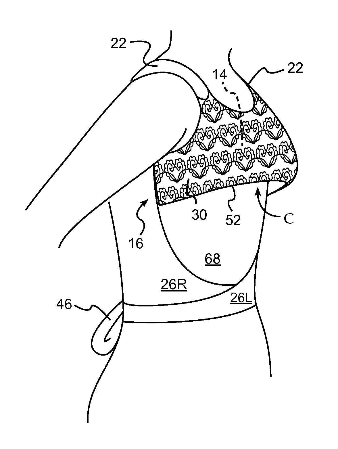 Wearable, combined garment and mastectomy prosthesis