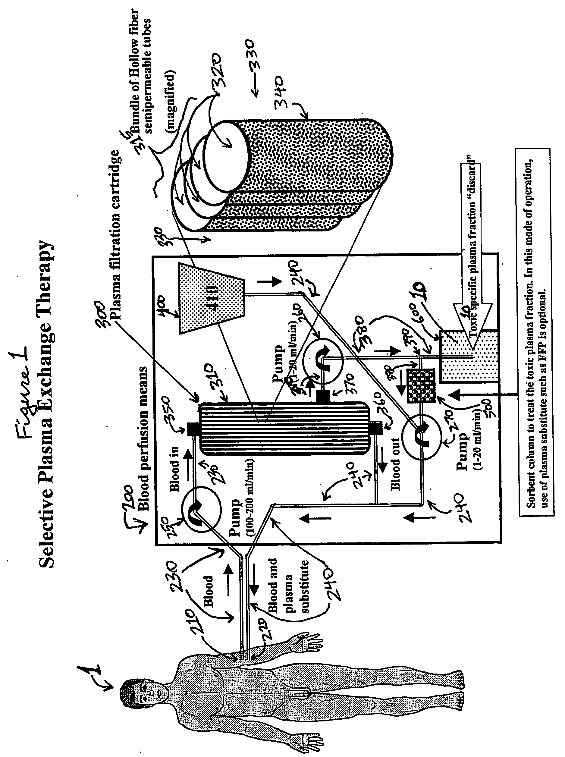 Selective plasma exchange therapy