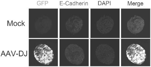 Usage of AAV-DJ type adeno-associated virus in-vitro efficient infection organoid