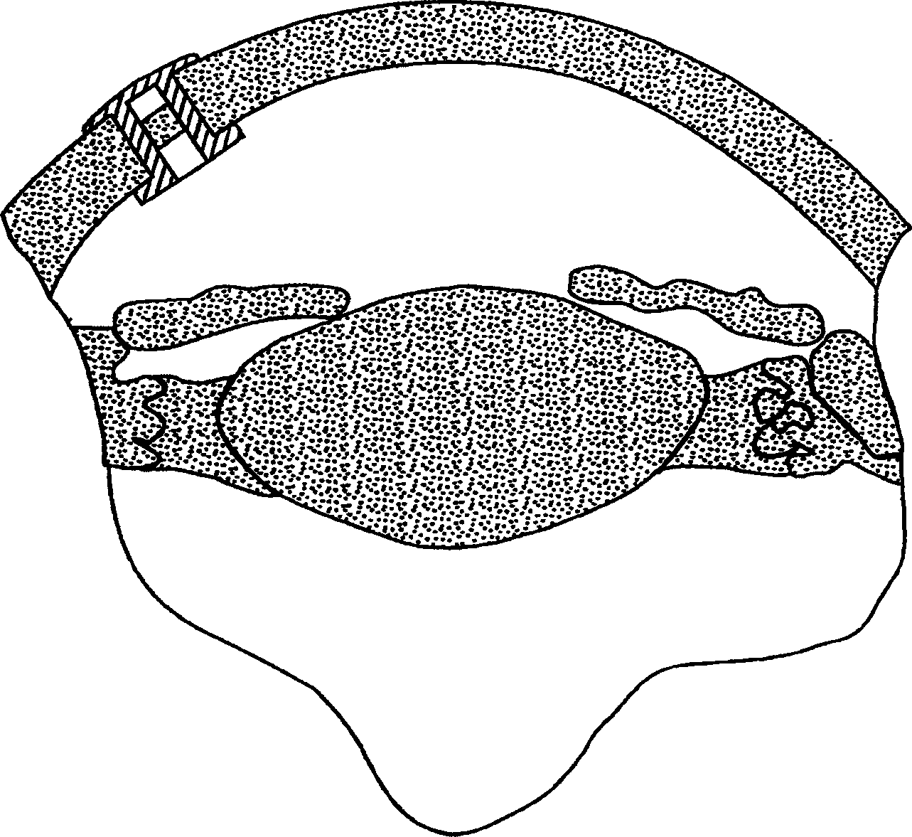 Insertion tool for ocular implant and method for using same