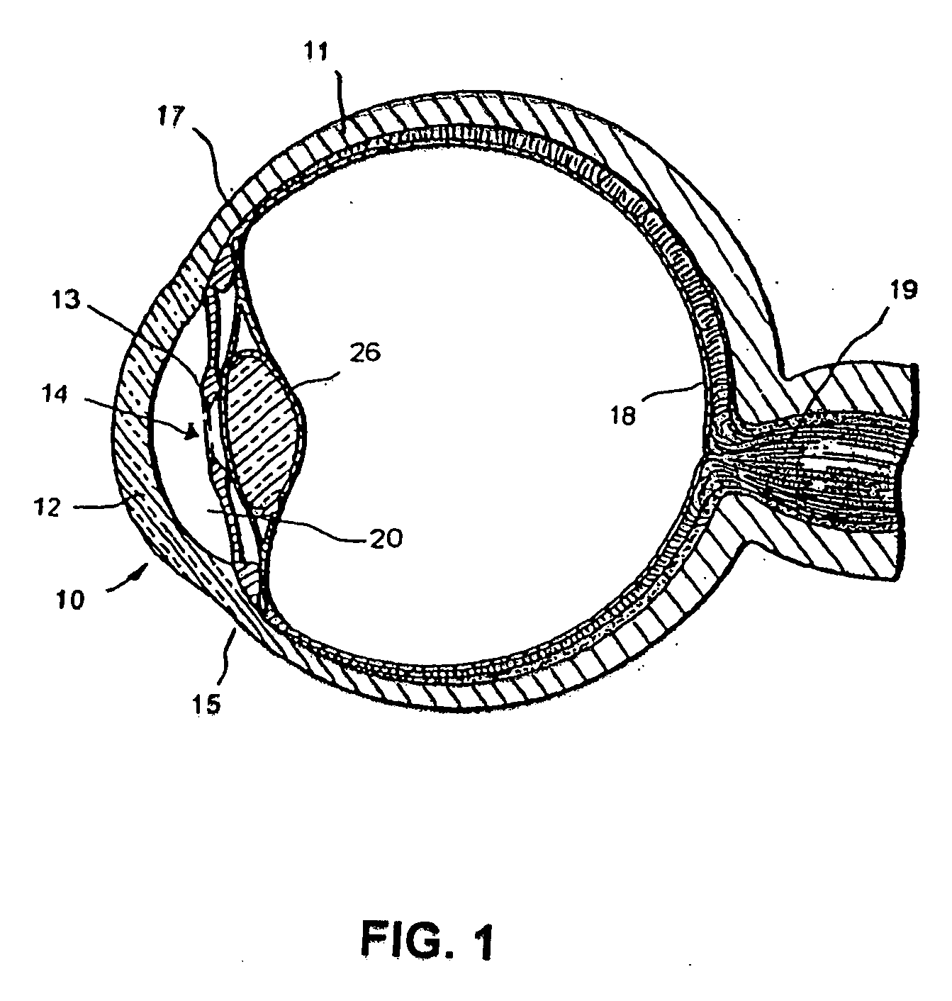 Contrast-enhanced ocular imaging