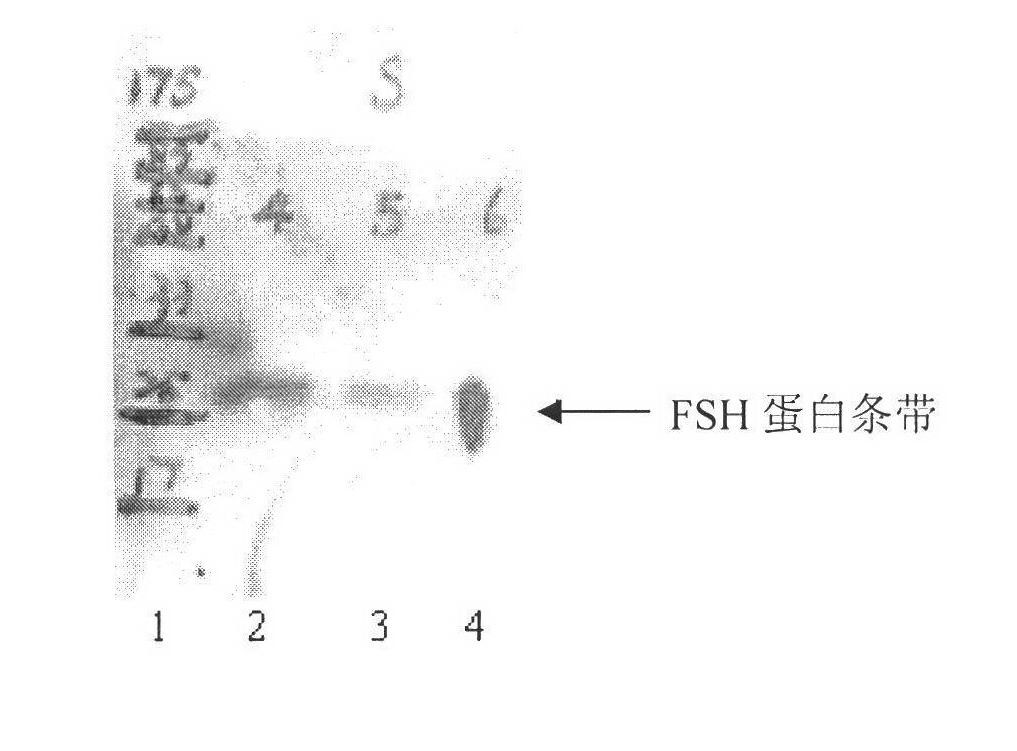 Recombinant human follicle-stimulating hormone and its preparation