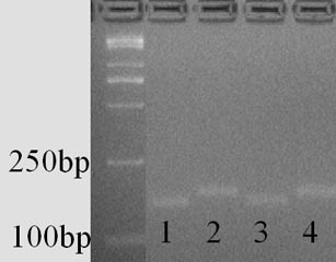 Molecular marker of maize high lysine gene zmcytmdh4 and its application