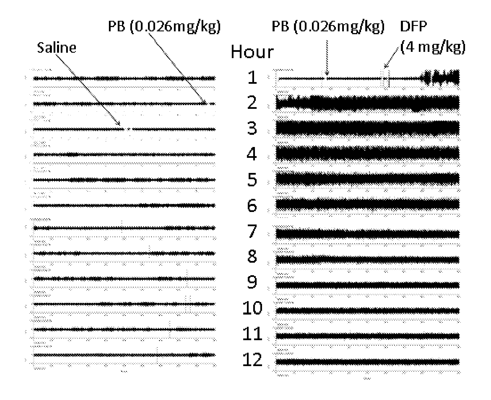 Methods and Compositions for Treating Status Epilepticus and Seizures Causing Status Epilepticus