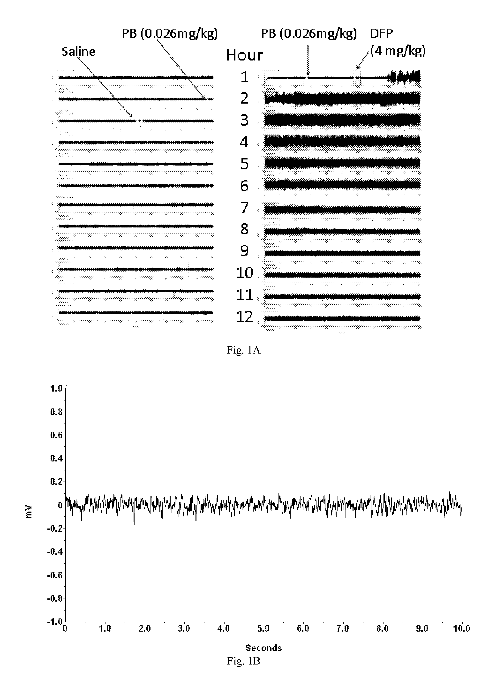 Methods and Compositions for Treating Status Epilepticus and Seizures Causing Status Epilepticus