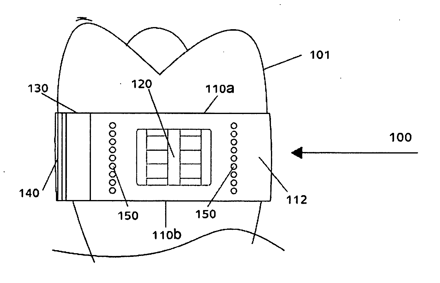 Orthodontic device