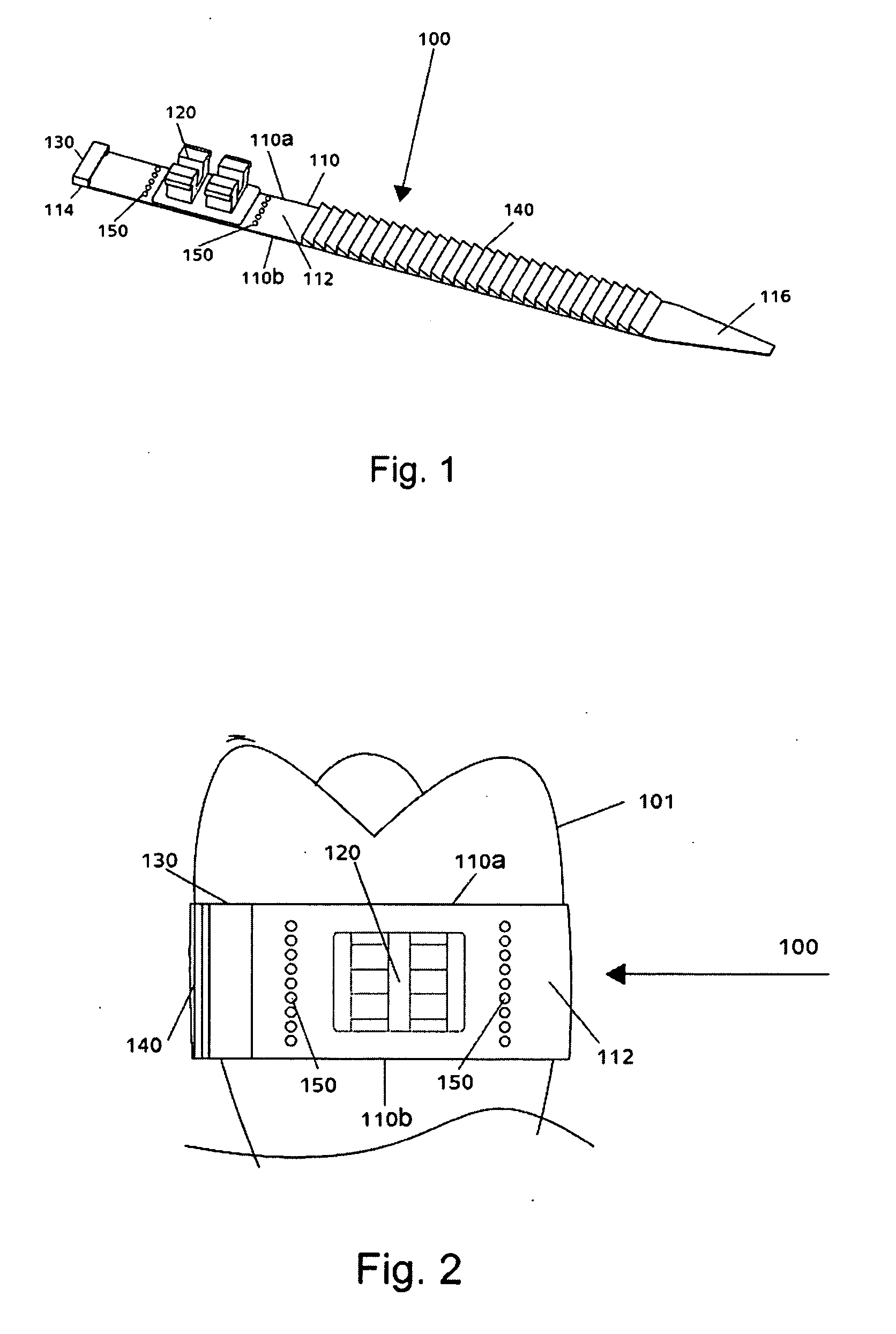 Orthodontic device