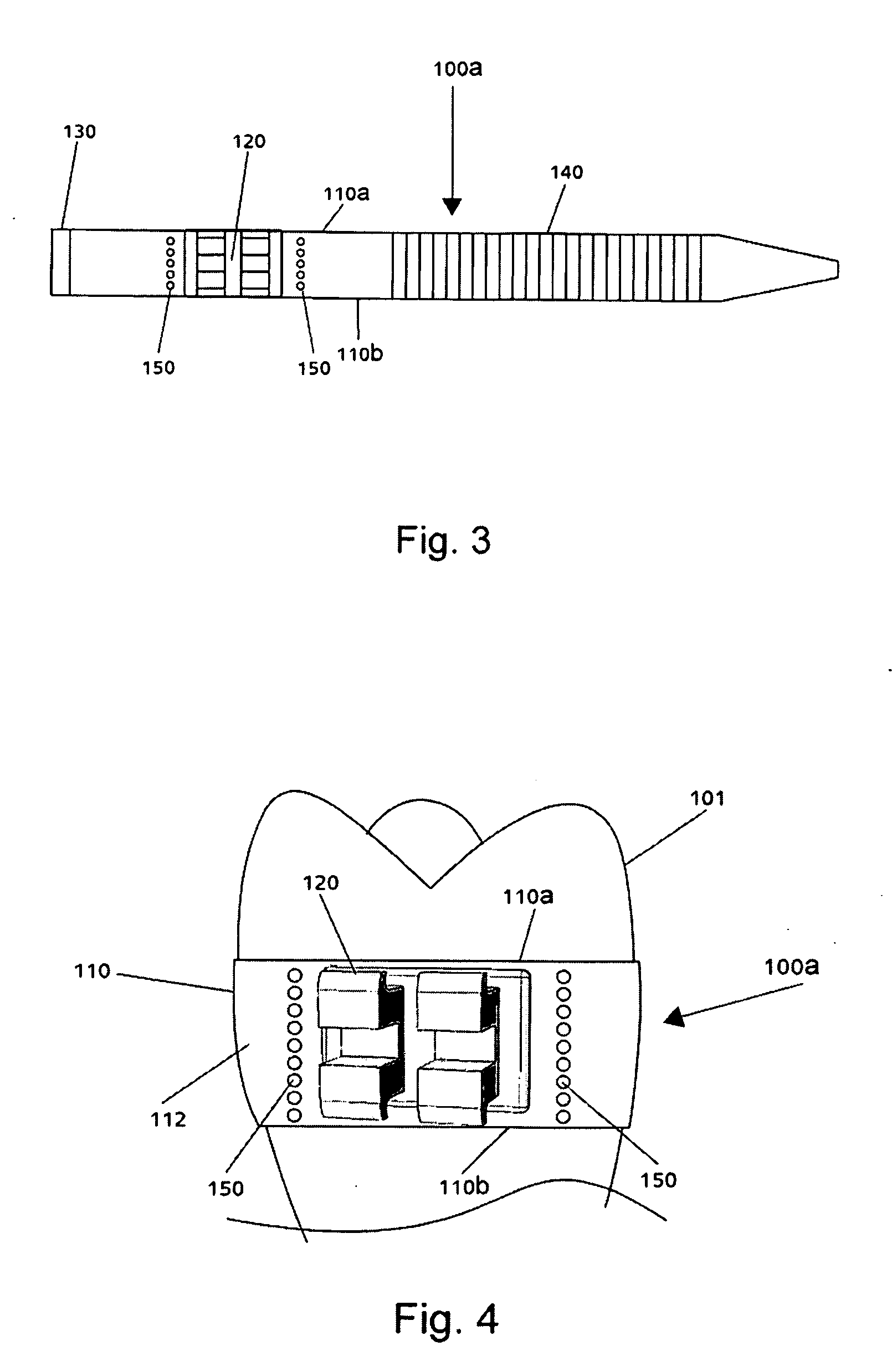 Orthodontic device