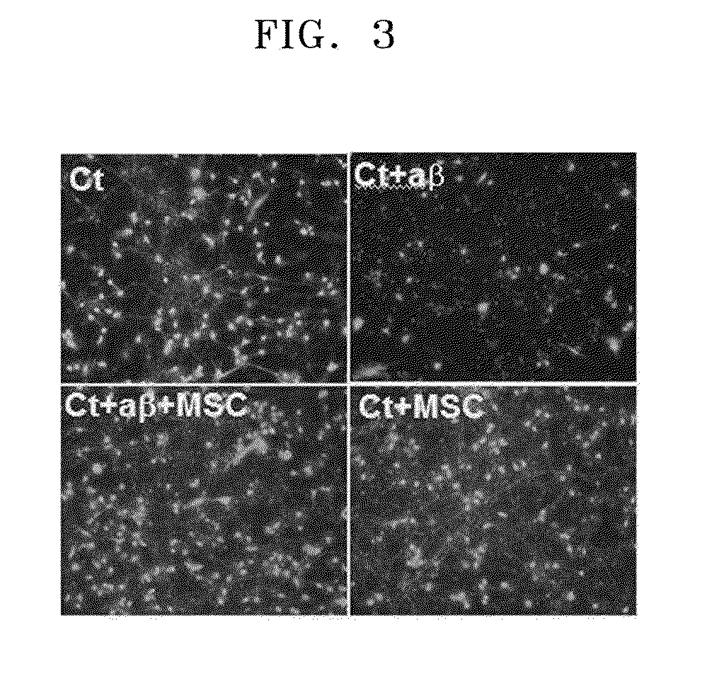 Composition comprising mesenchymal stem cells or culture solution of mesenchymal stem cells for the prevention or treatment of neural diseases