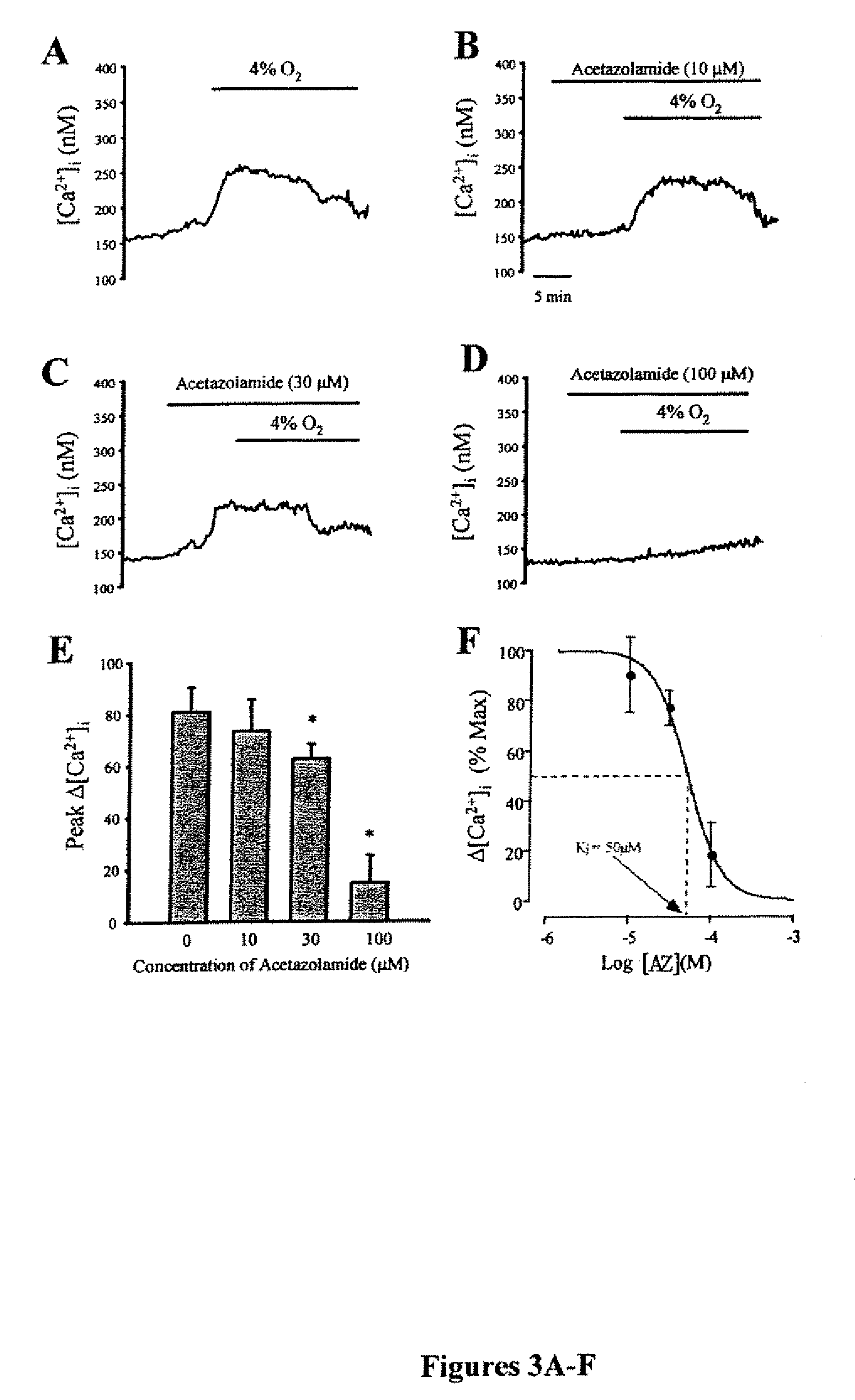 Methods of treating pulmonary disease using acetazolamide and structurally related derivatives
