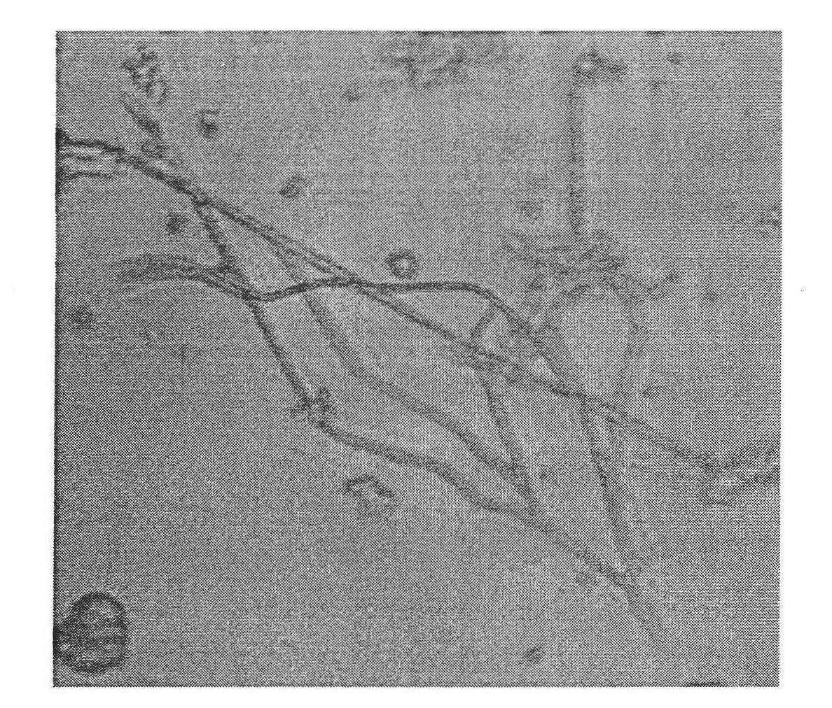 Method for preparing marine actinomyces and metabolite thereof and application