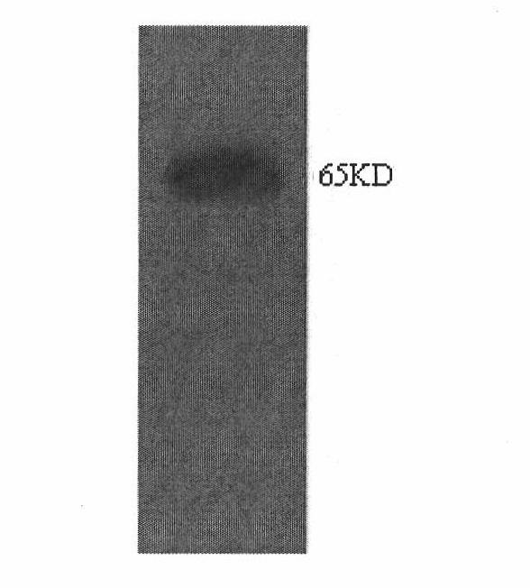 Recombinant saccharomyces cerevisiae for producing ethanol by xylose fermentation and construction method thereof