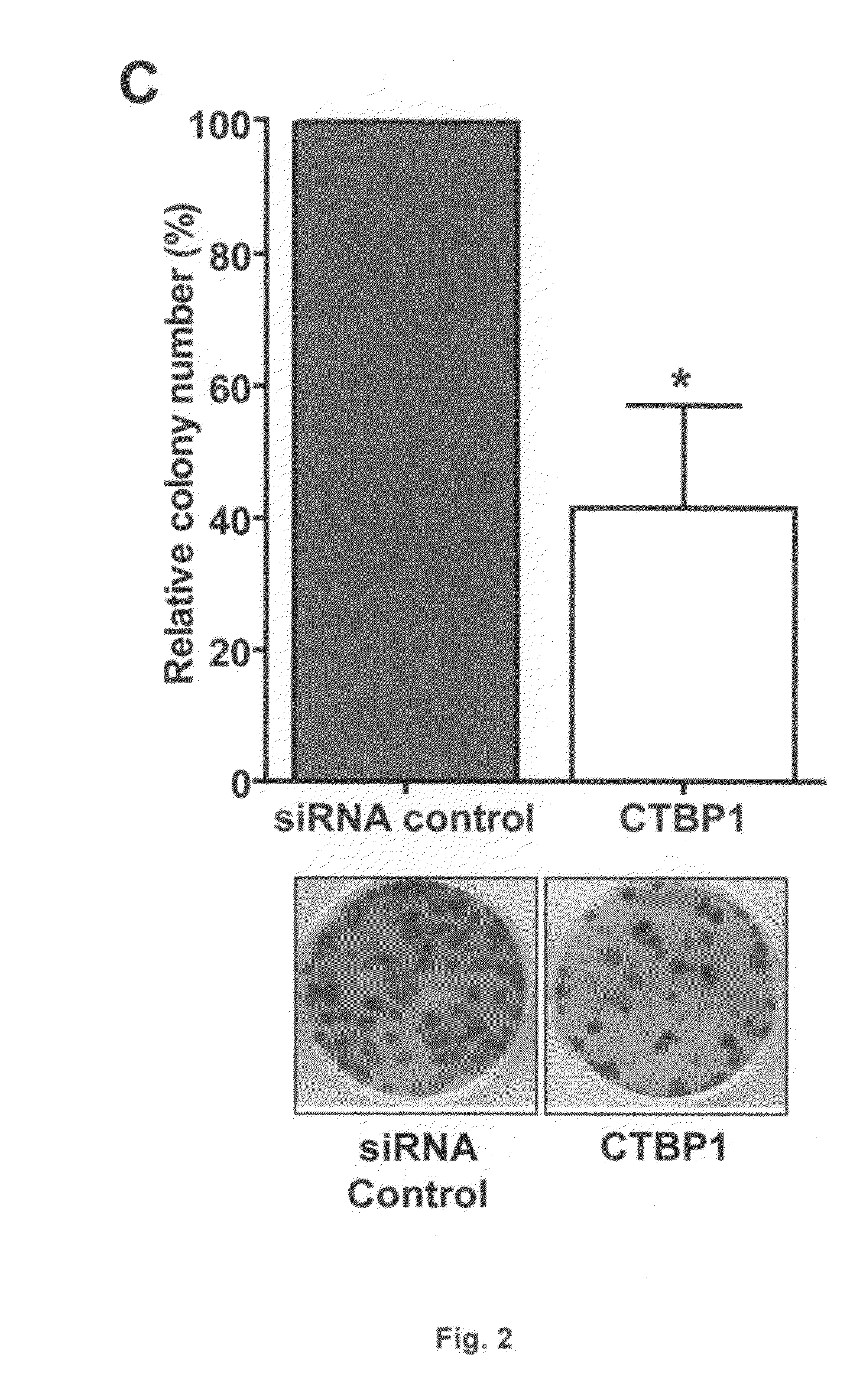 USE OF CTBP1 siRNA FOR THE TREATMENT OF GASTRIC CANCER