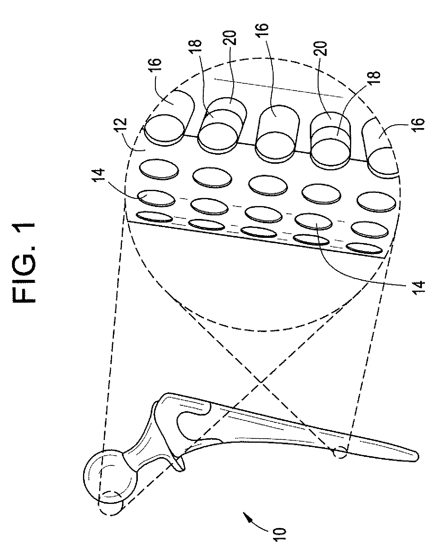 Medical and dental implant devices for controlled drug delivery