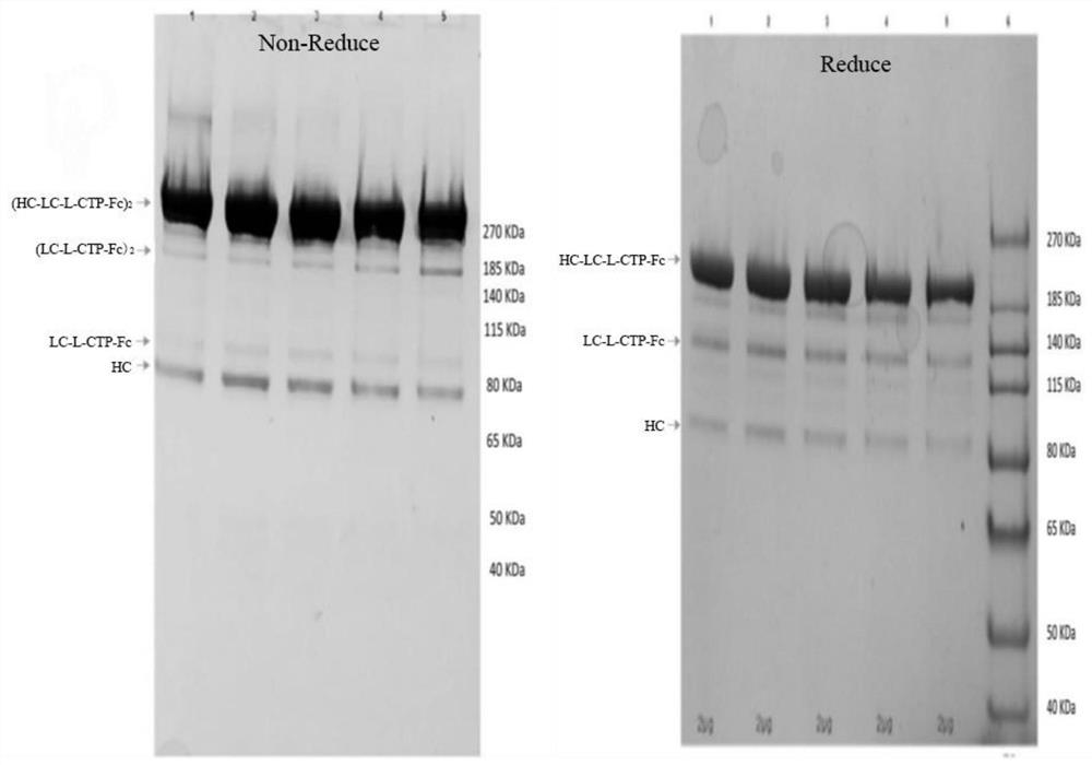 Mutant single-chain human blood coagulation factor VIII fusion protein and its preparation method and application