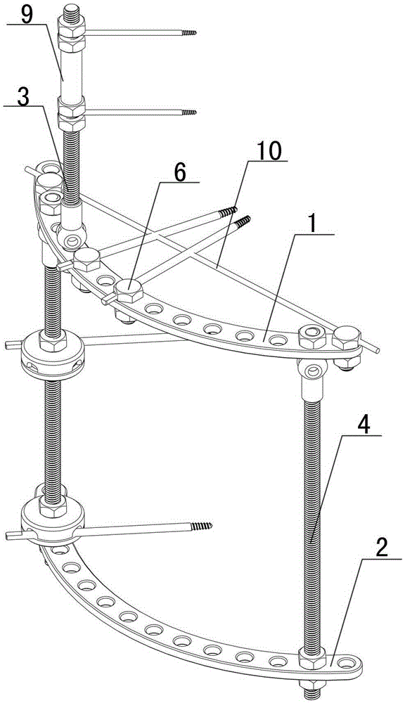 Dynamic and static control external fixator for distal radius fracture