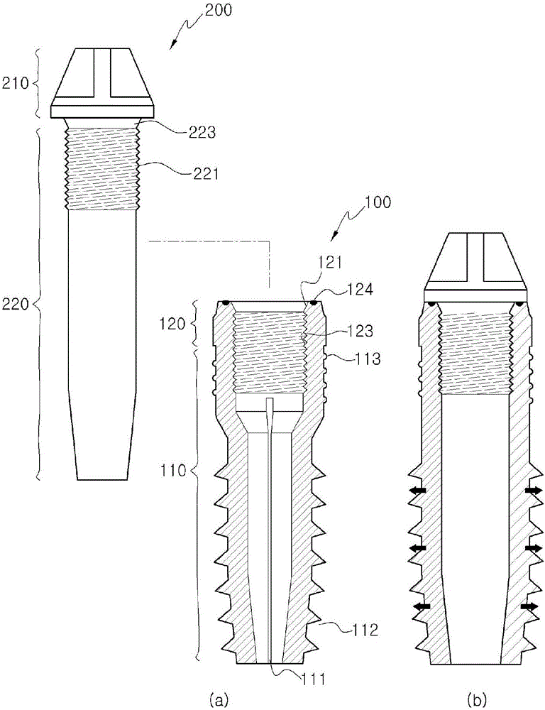 Spike-fixing type implant and method for implanting same