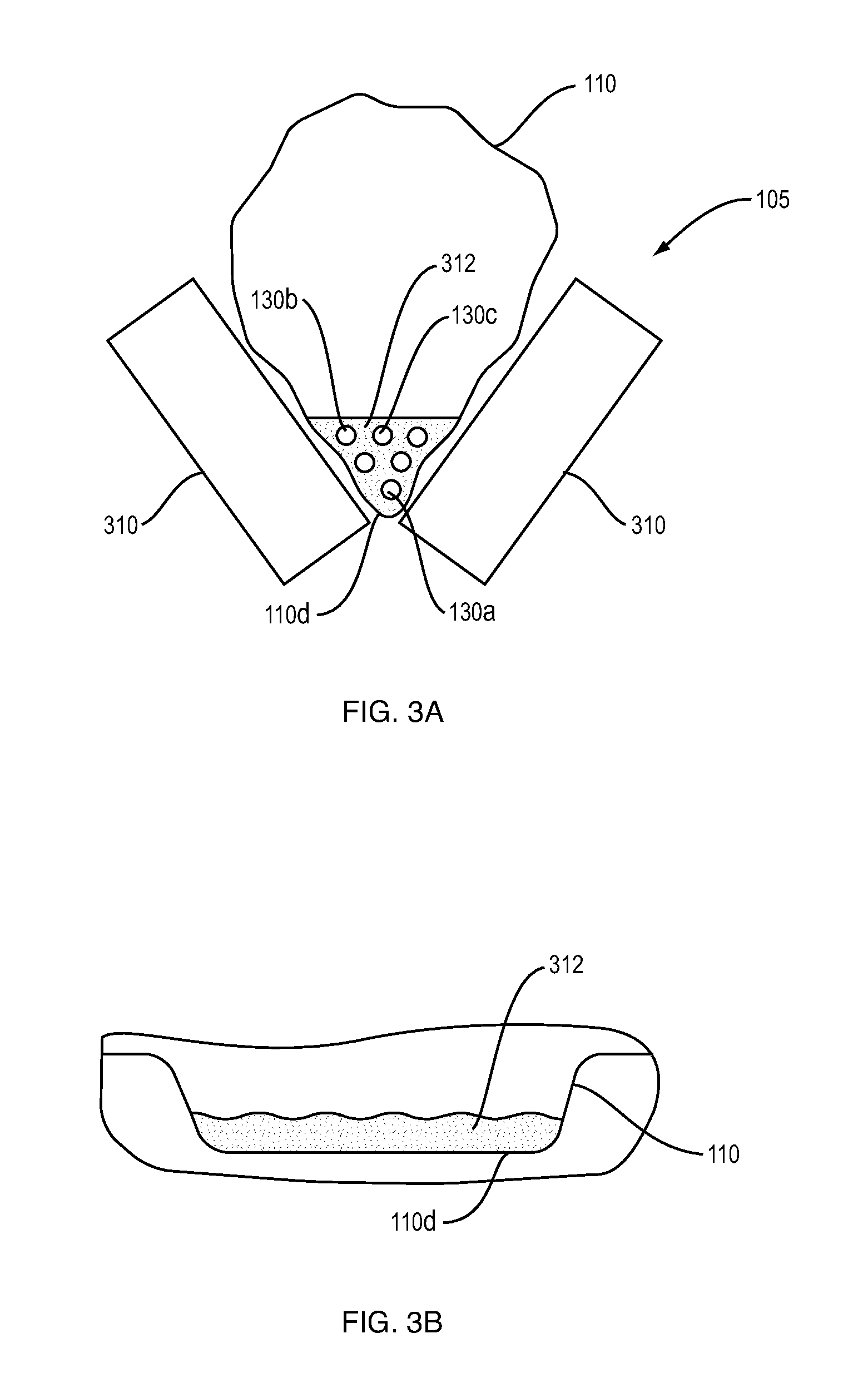 Tissue and organ graft bioreactor and method of operation