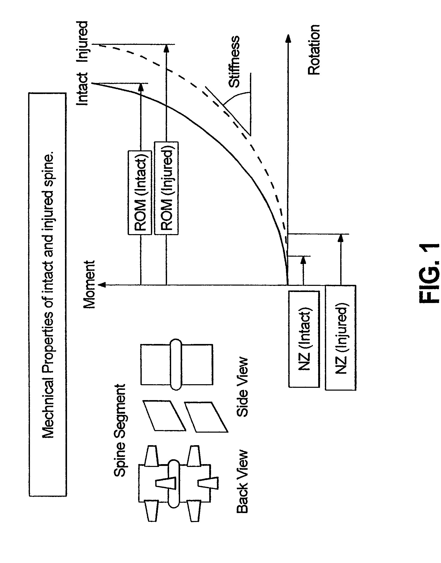 Dynamic spine stabilizer