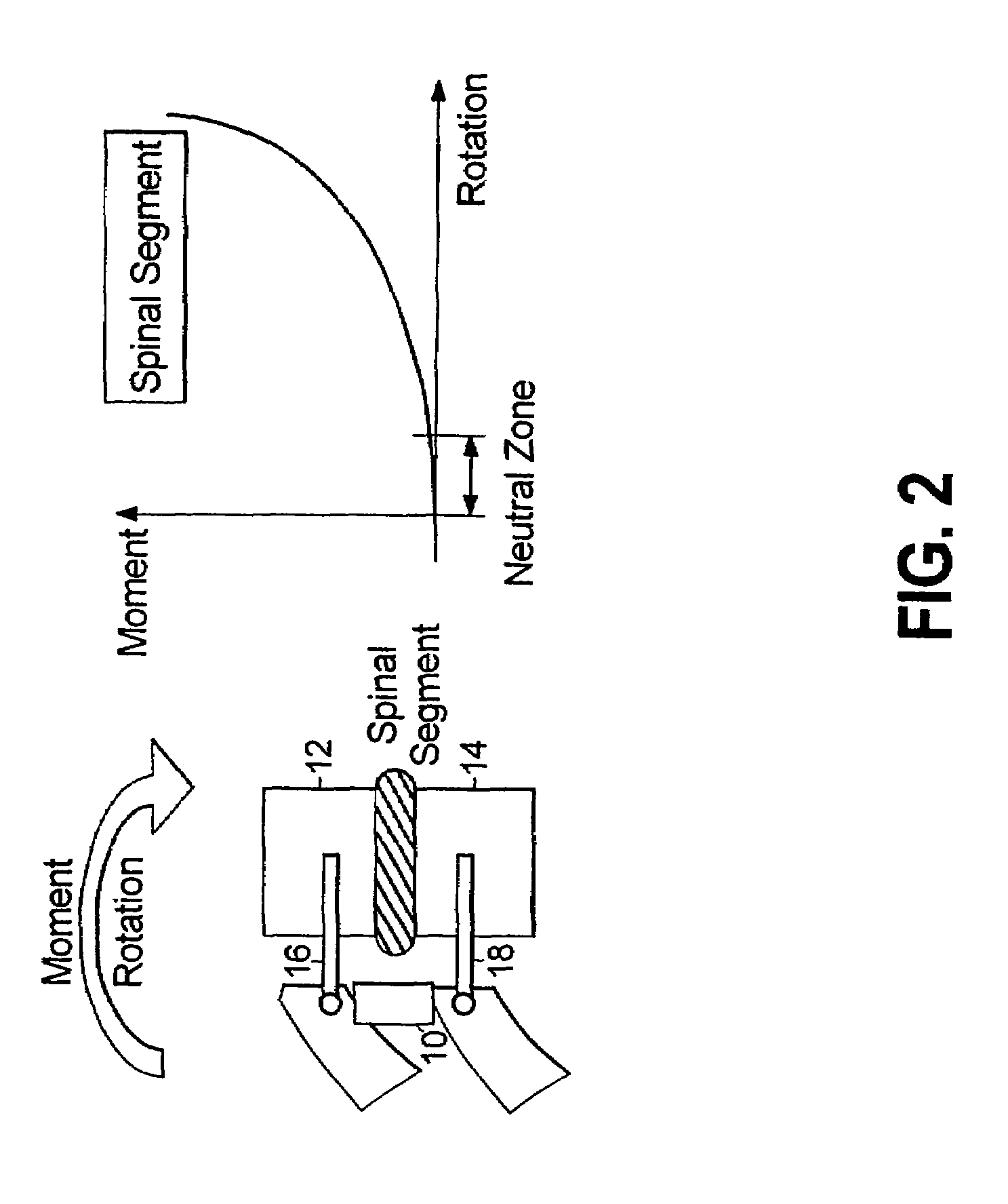 Dynamic spine stabilizer