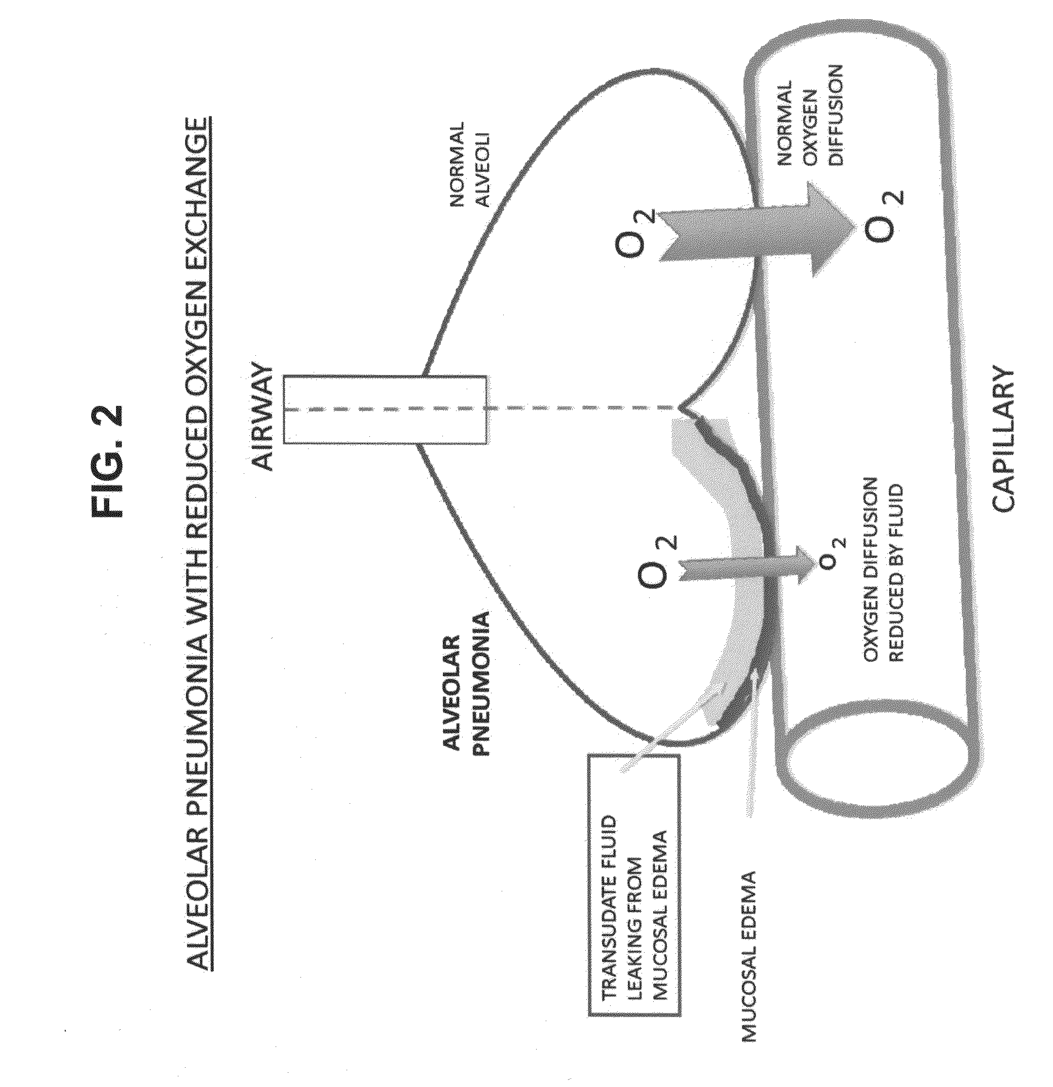 Compositions and methods for treatment of diseases and conditions with increased vascular permeability