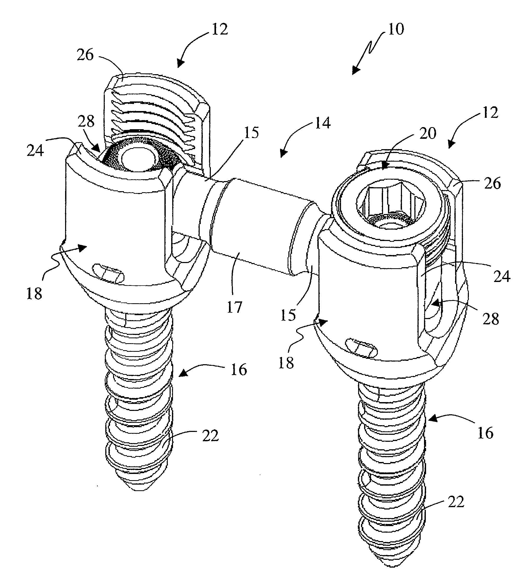 System and Methods For Performing Spinal Fixation
