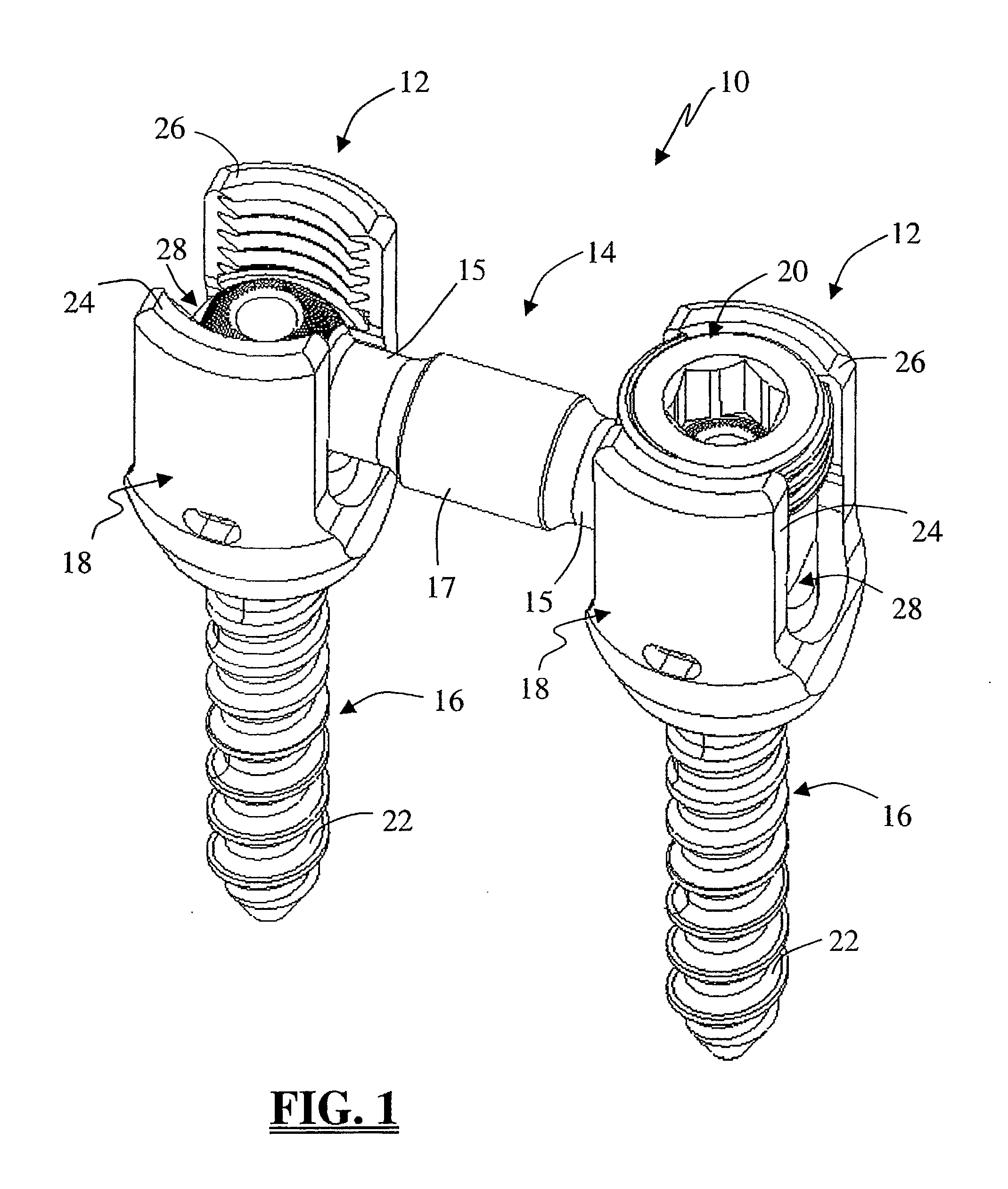 System and Methods For Performing Spinal Fixation
