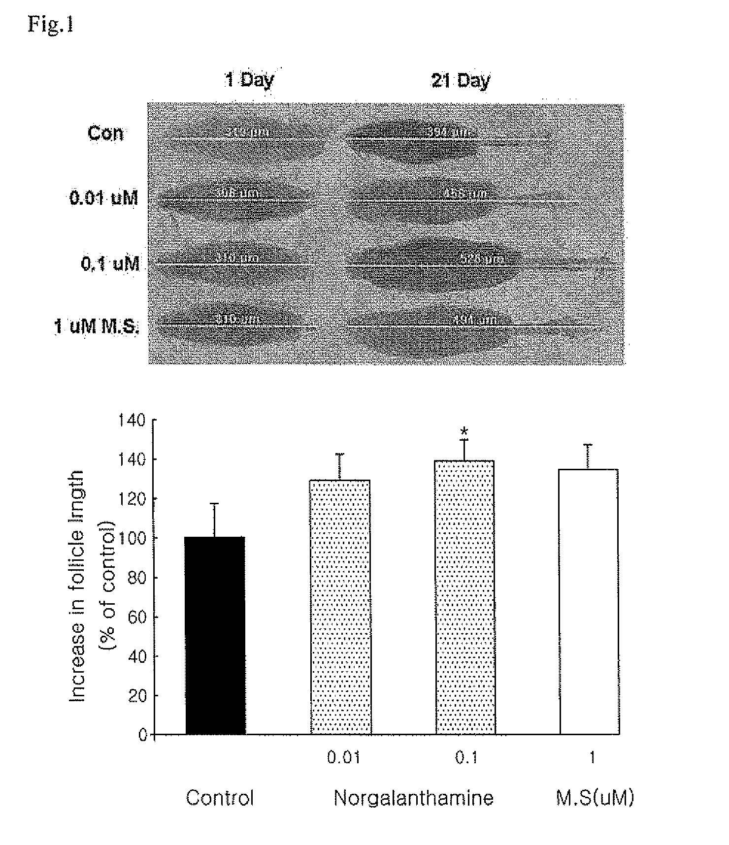 Composition for Preventing and Treating Alopecia Disorder Containing Morgalanthamine Compounds as an Active Ingredient