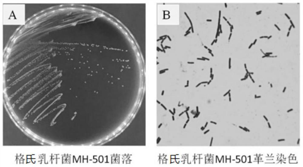 Lactobacillus gasseri for preventing and treating urogenital infection and application thereof