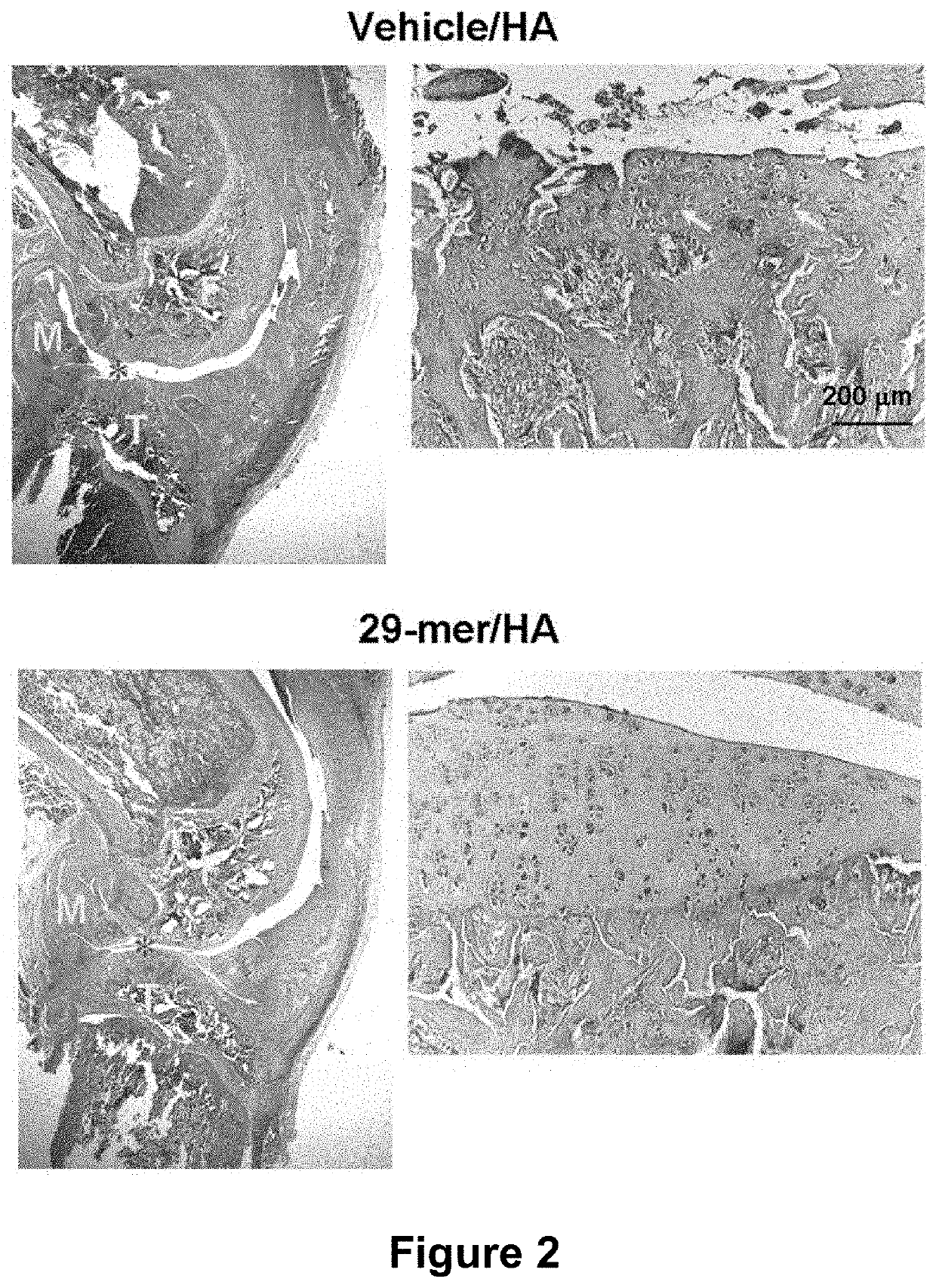 Application of pedf-derived short peptides in the treatment of osteoarthritis