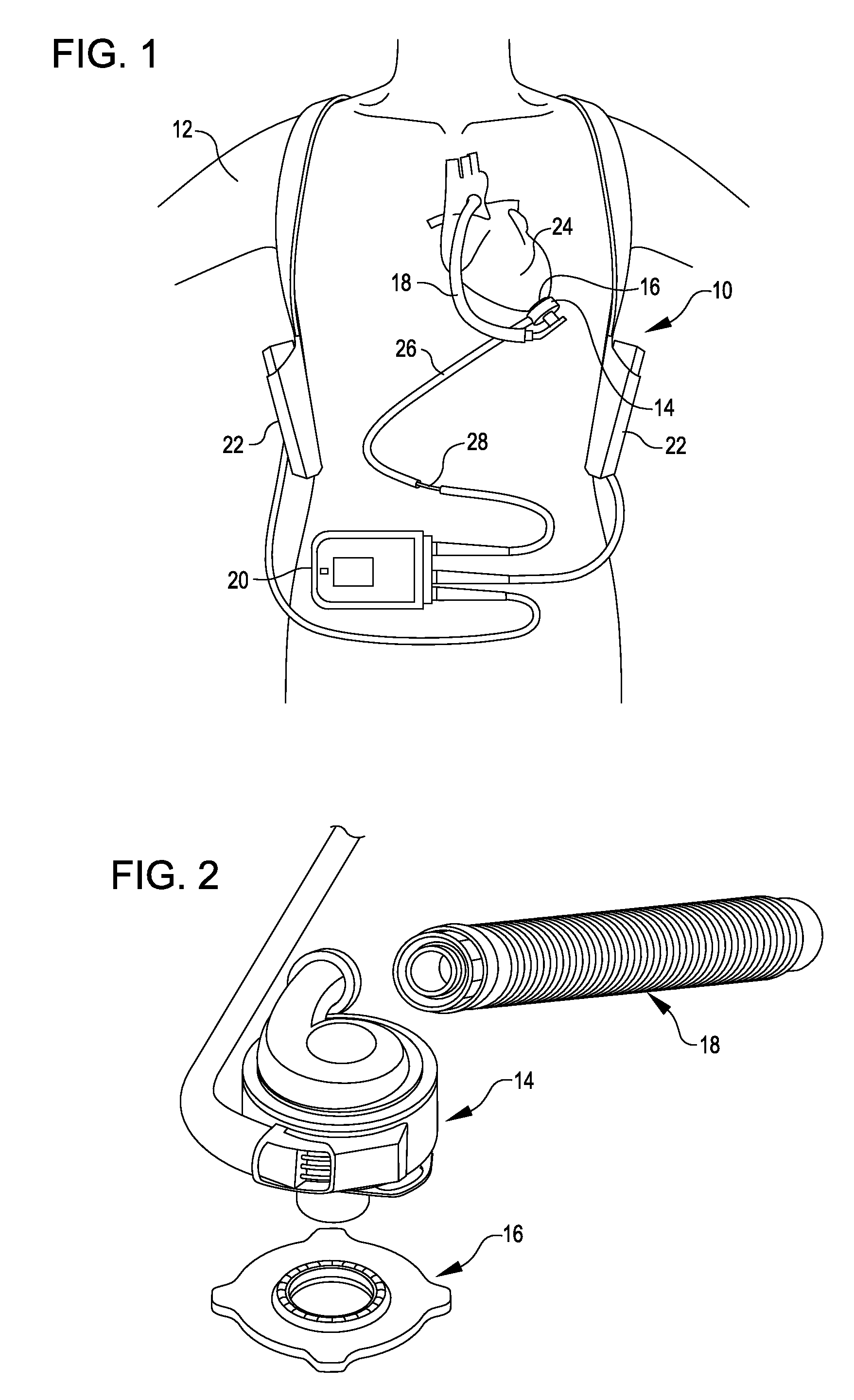 Methods and systems for providing battery feedback to patient