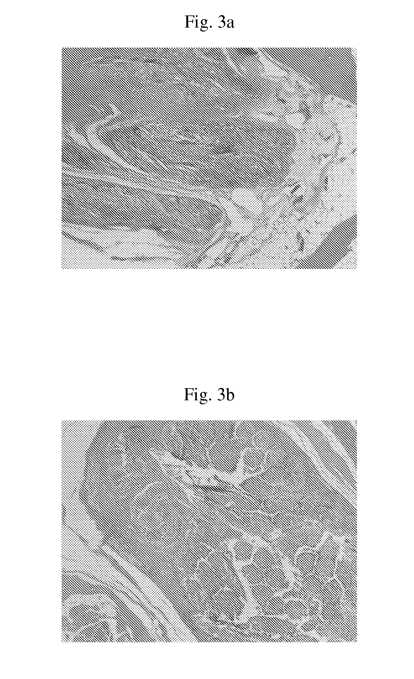 Composite support containing silk and collagen, and preparation method thereof
