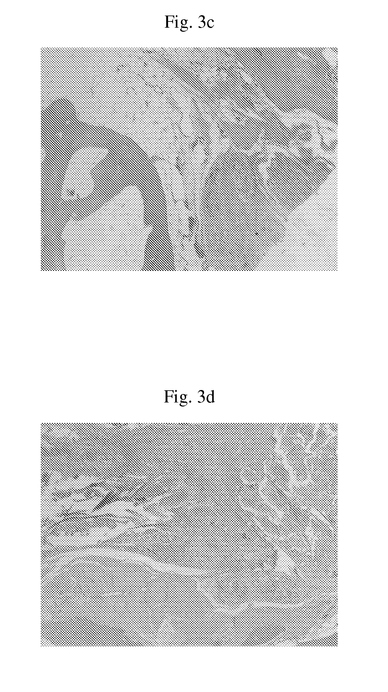 Composite support containing silk and collagen, and preparation method thereof